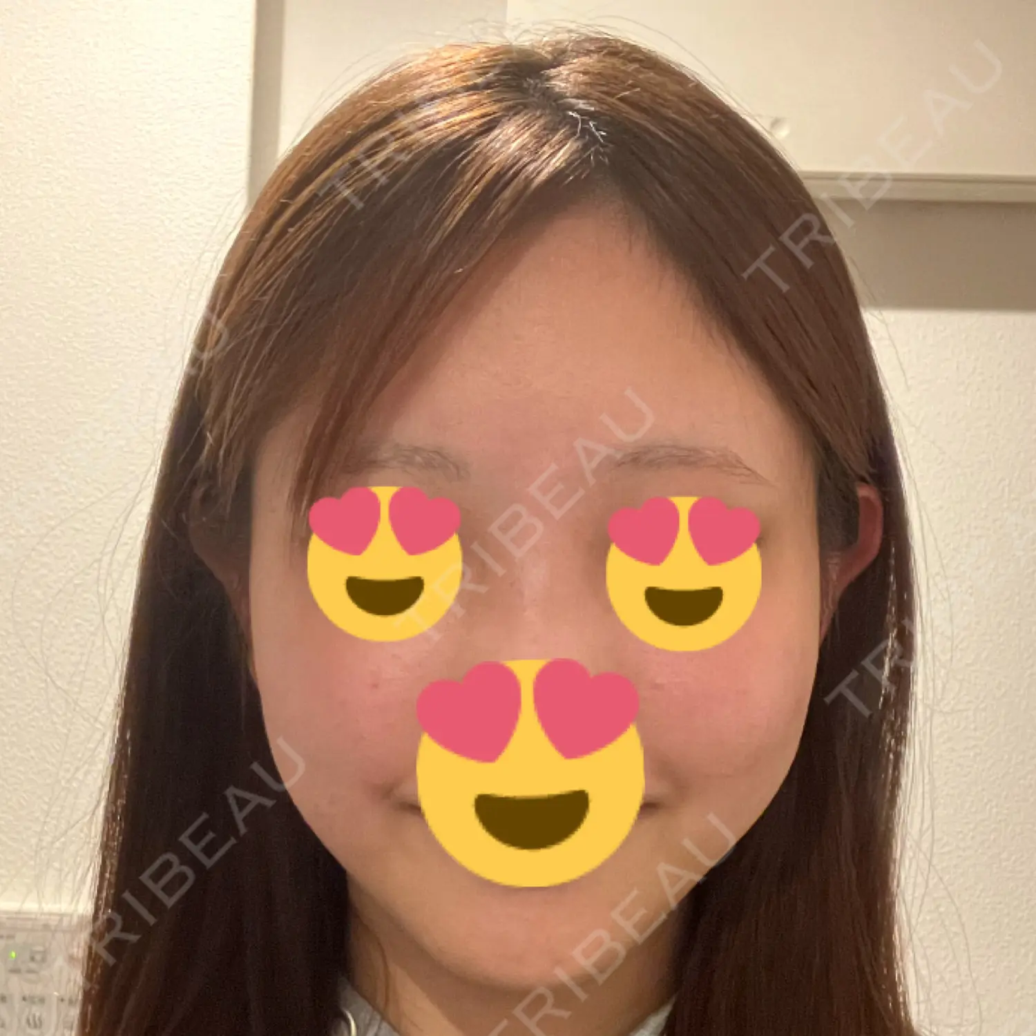施術前の写真