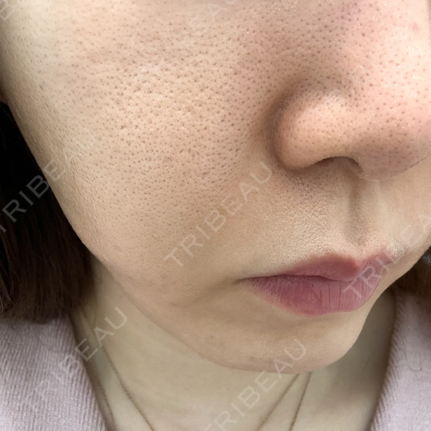 施術前の写真