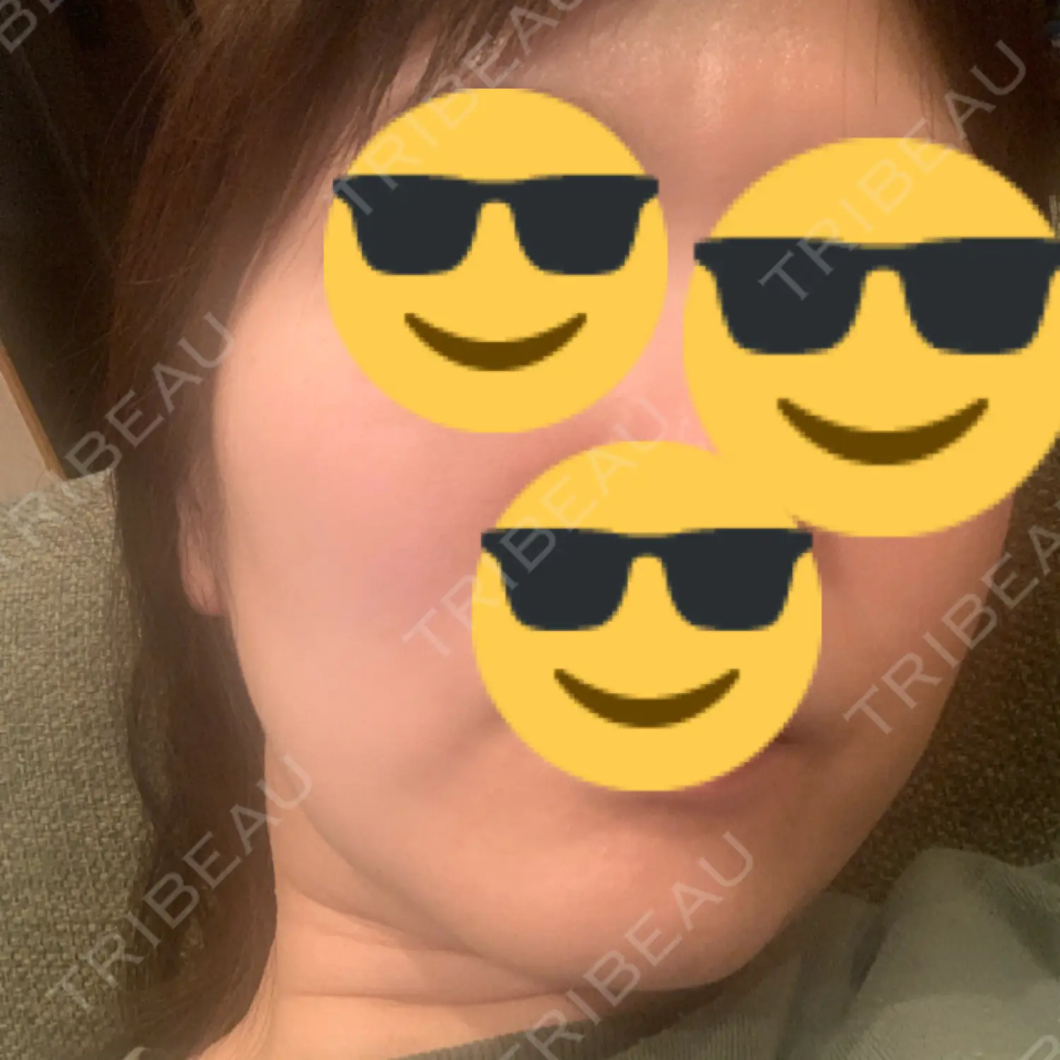 施術前の写真