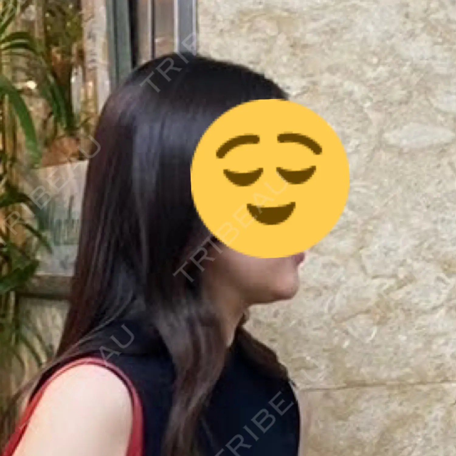 施術前の写真