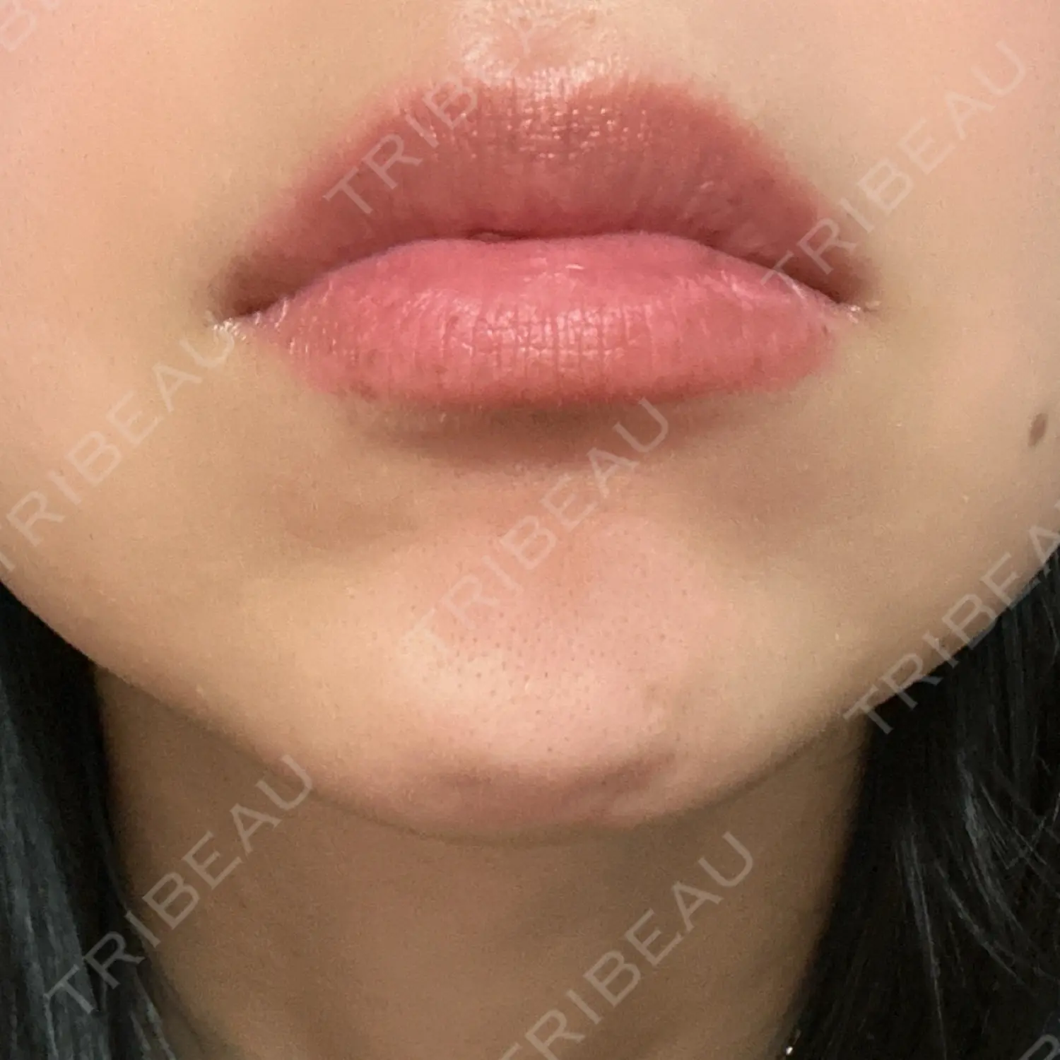 施術前の写真