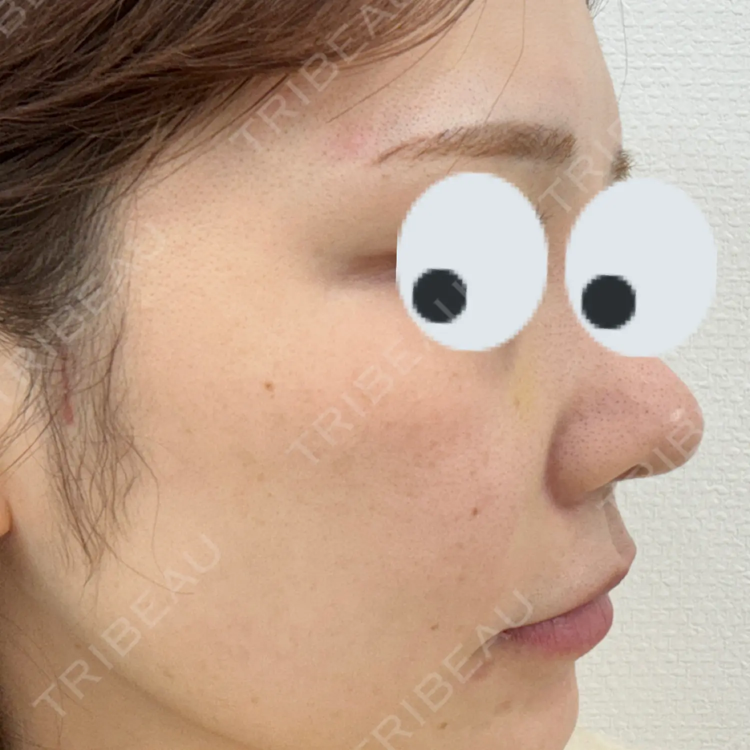 施術前の写真