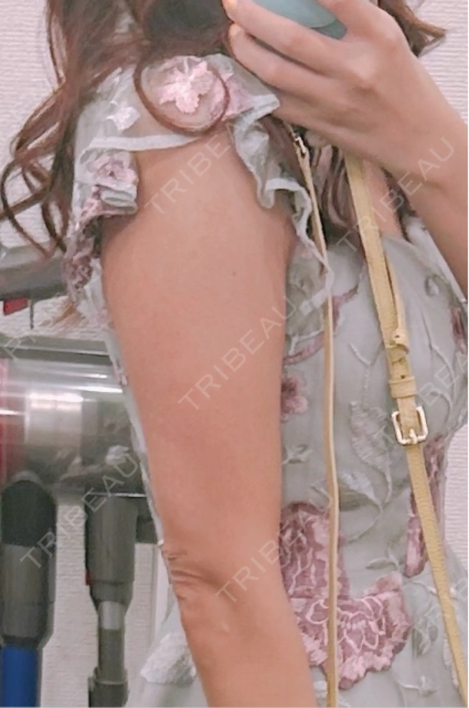 施術前の写真
