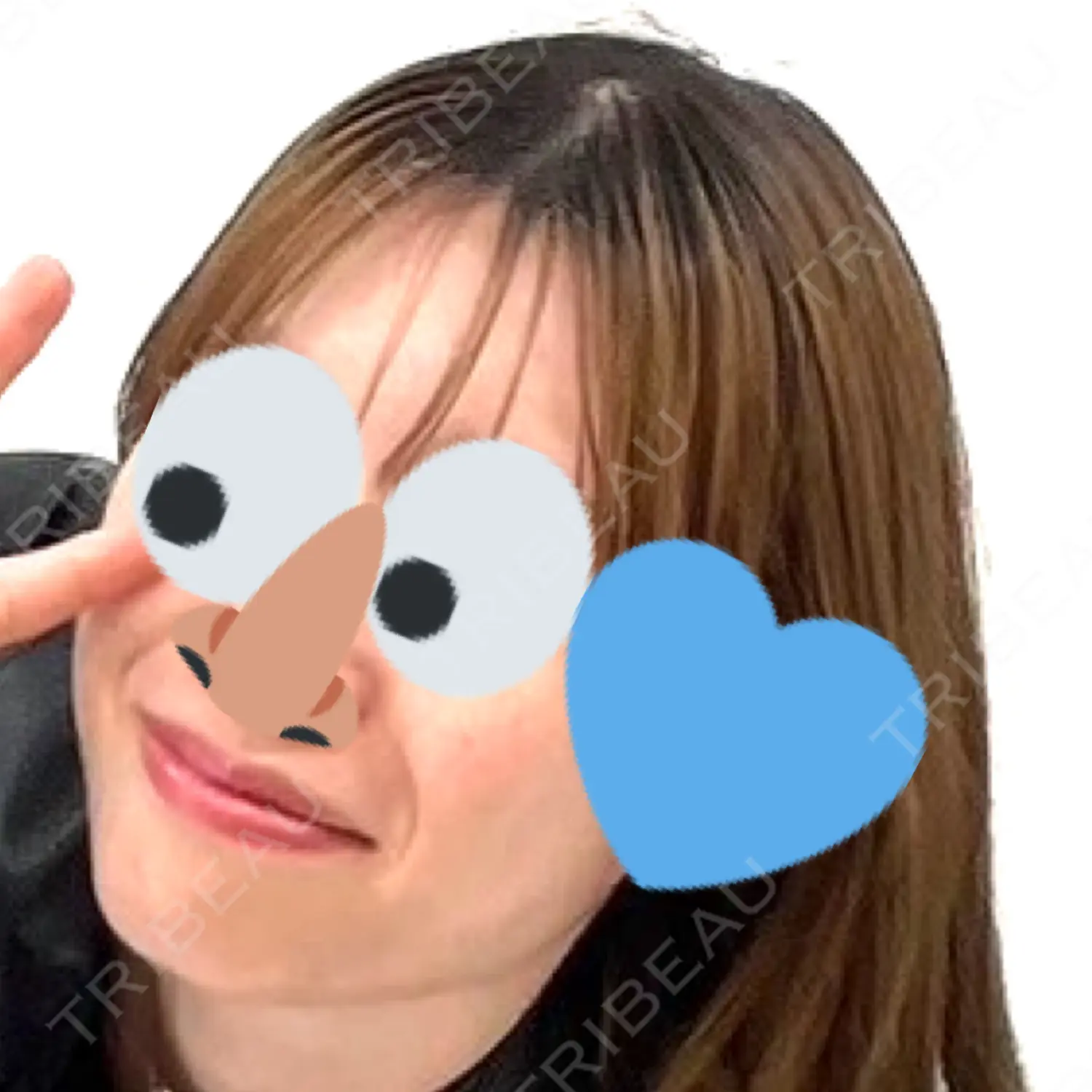 施術前の写真
