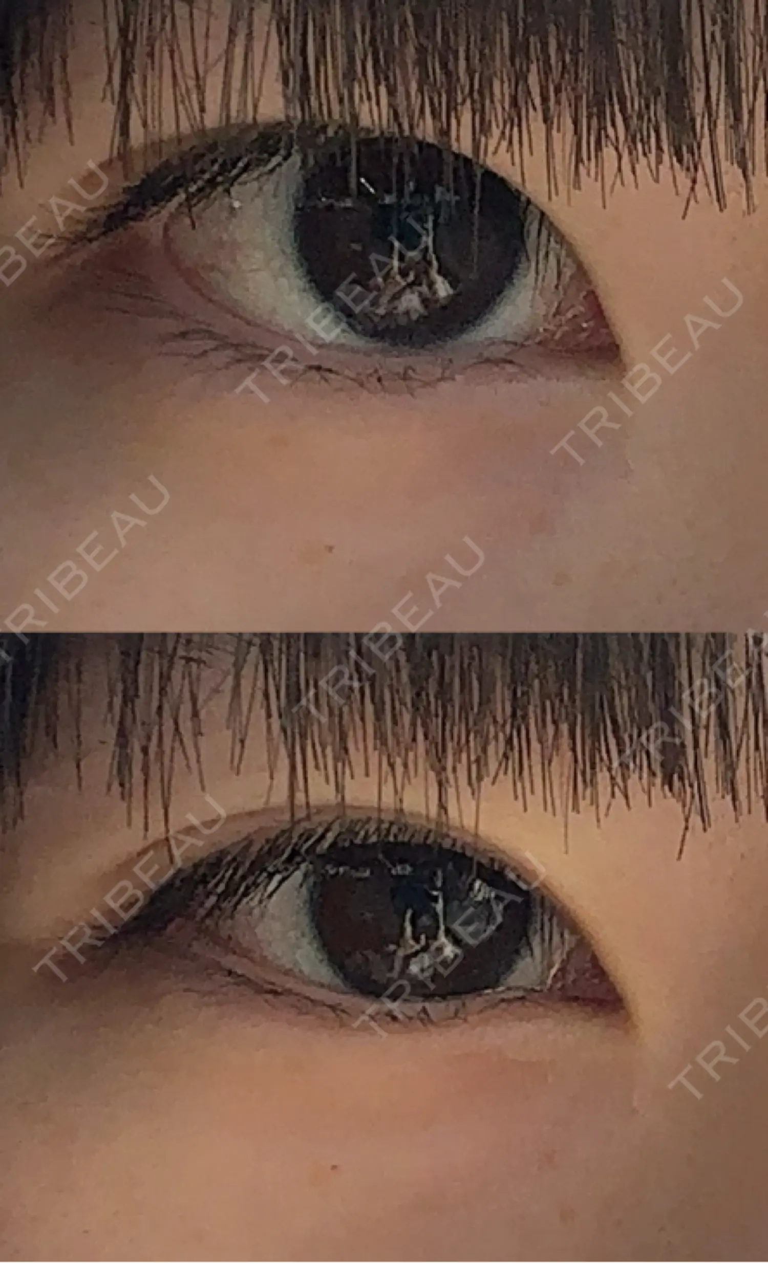 施術前の写真