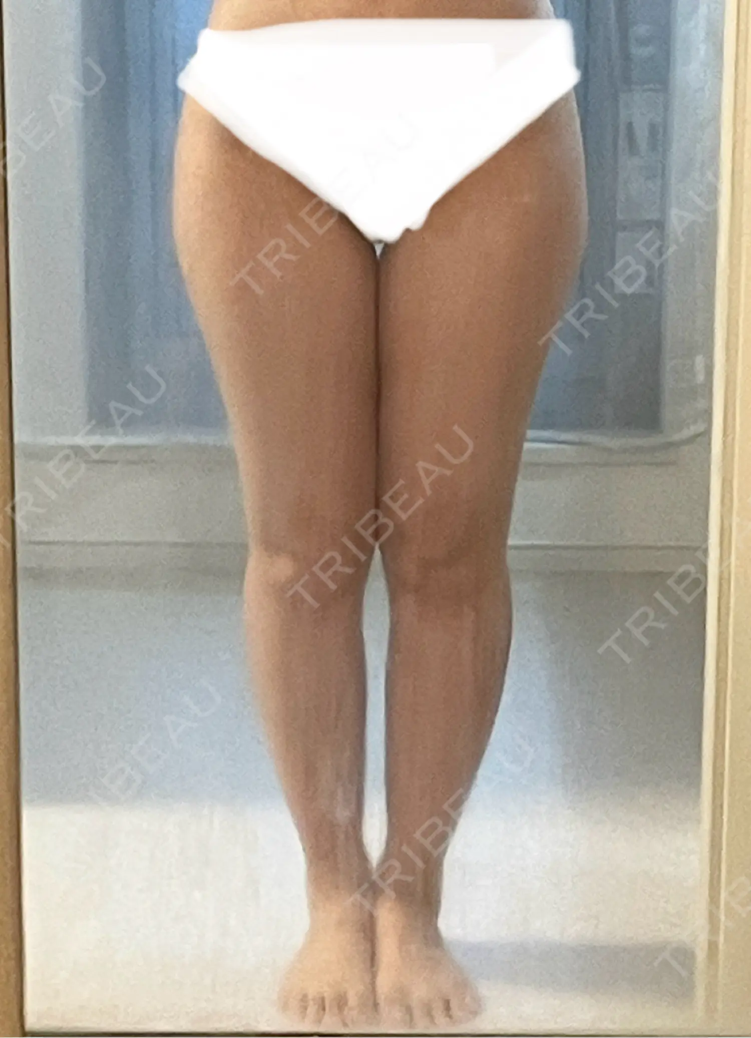 施術前の写真