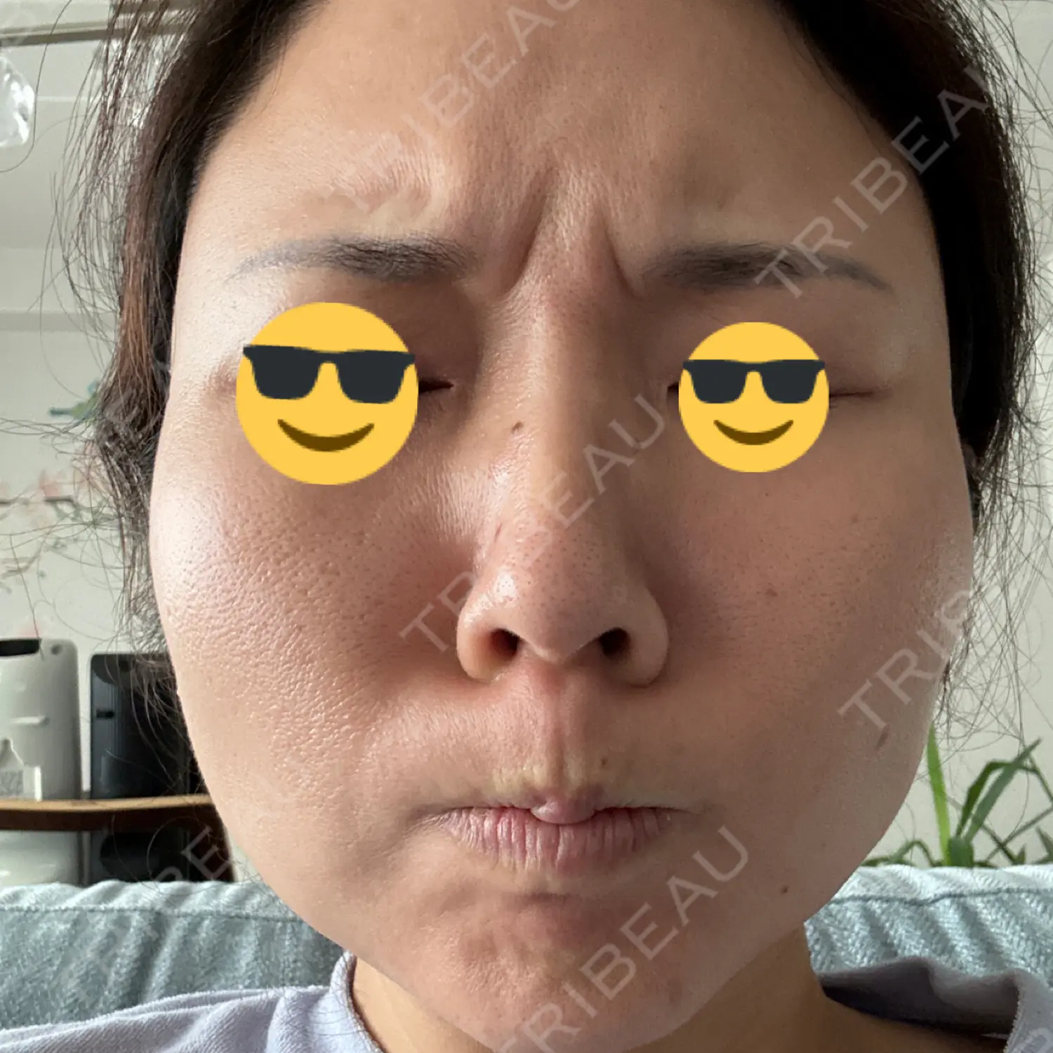 施術前の写真
