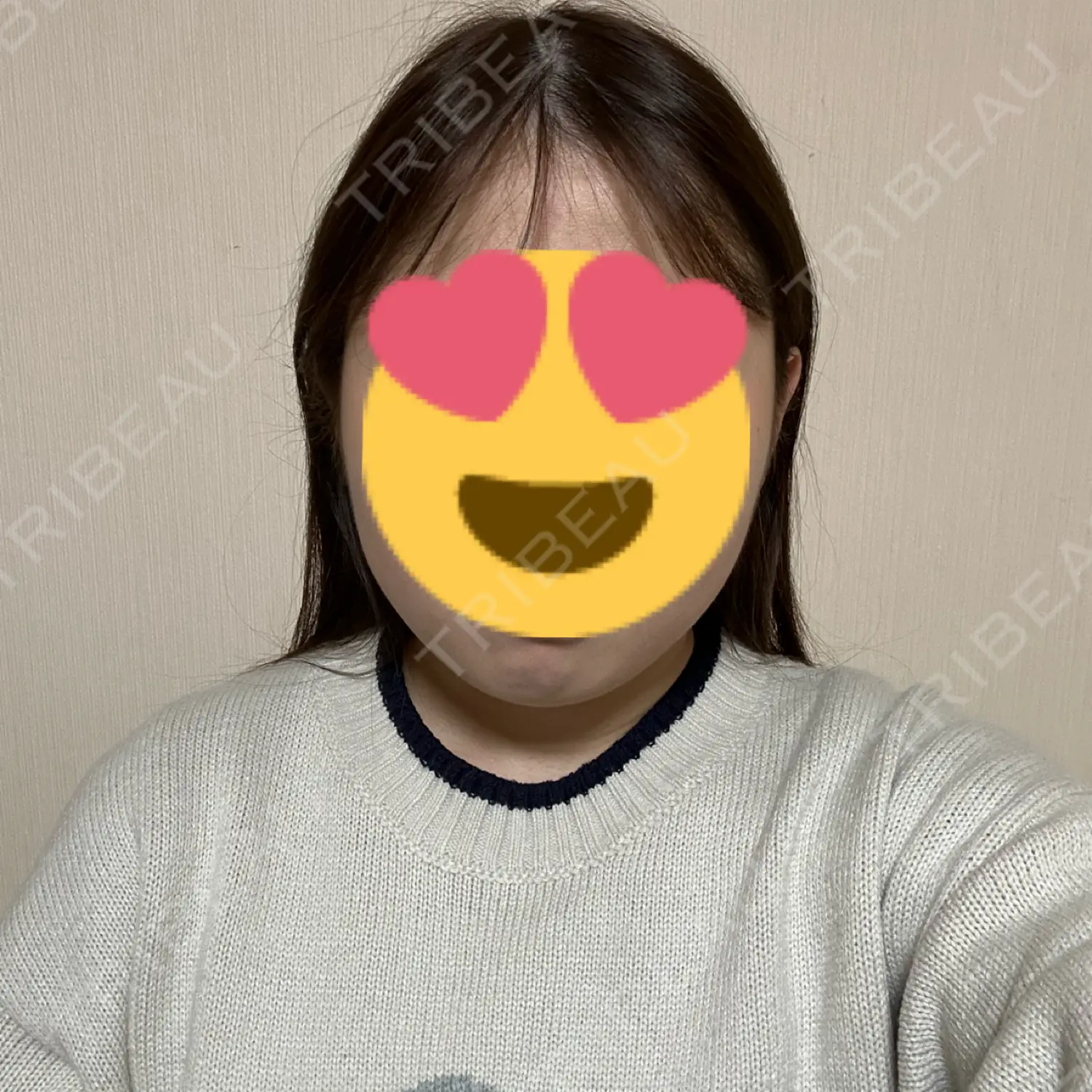 施術前の写真