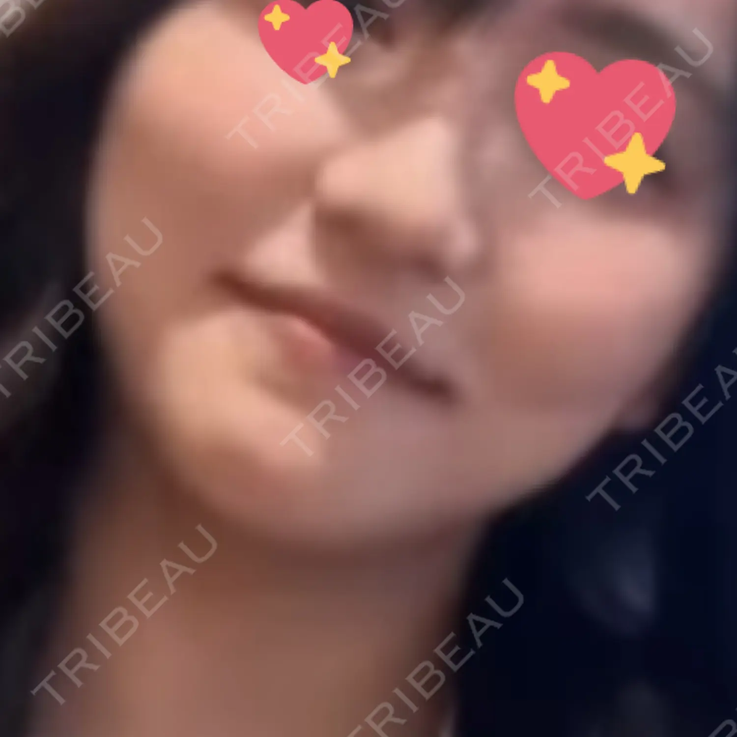 施術前の写真