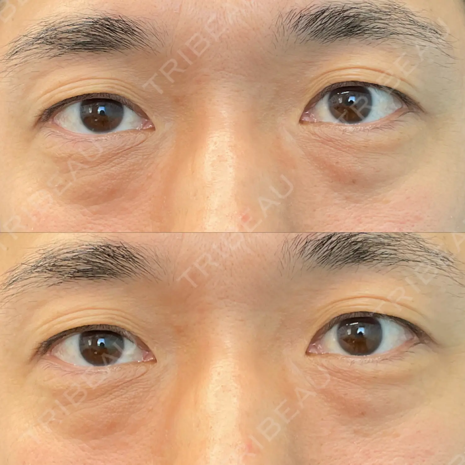 施術前の写真