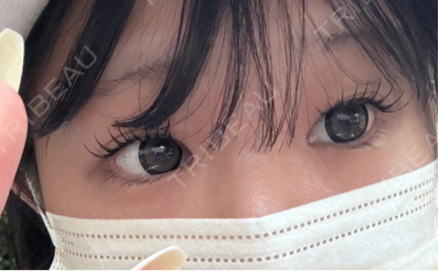 施術前の写真