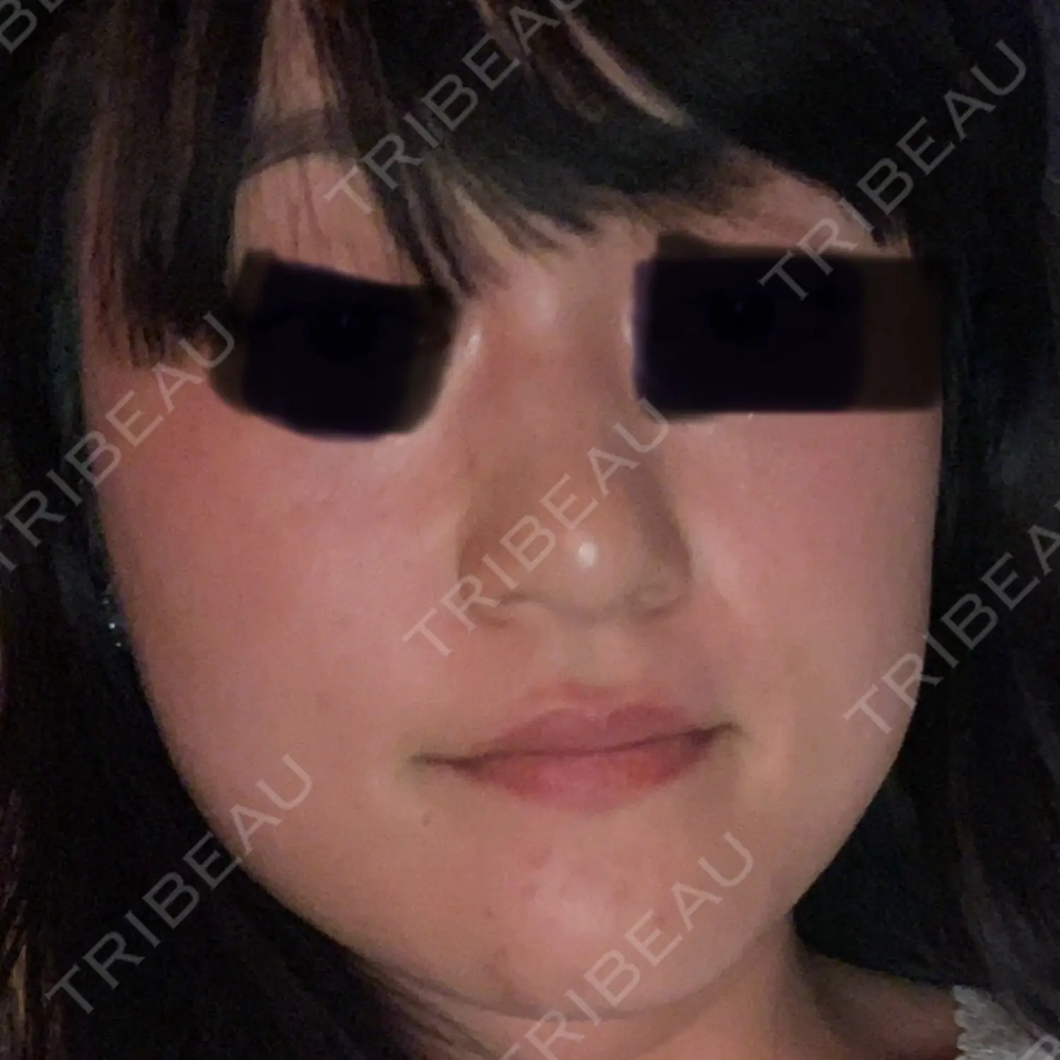 施術前の写真