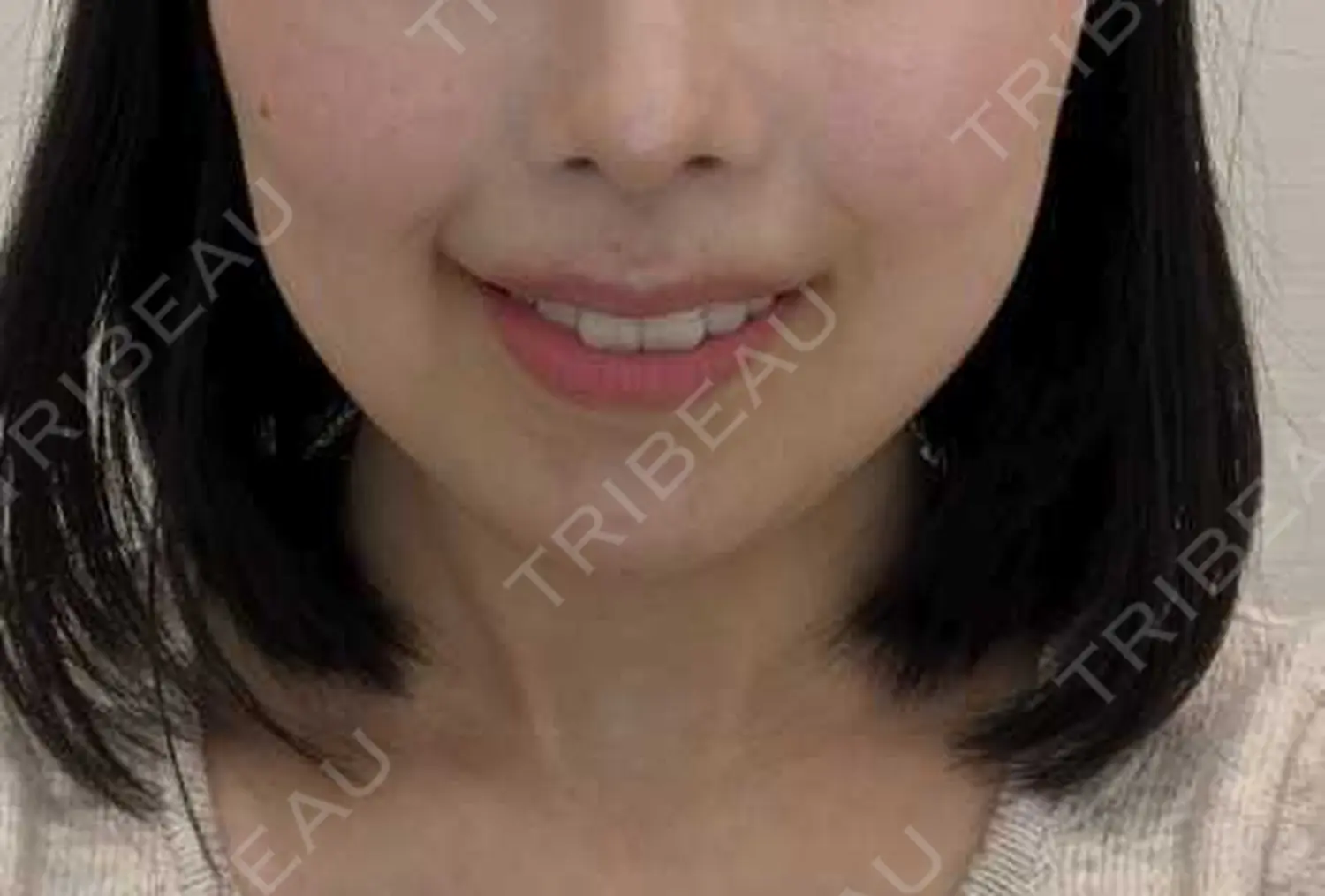 施術前の写真