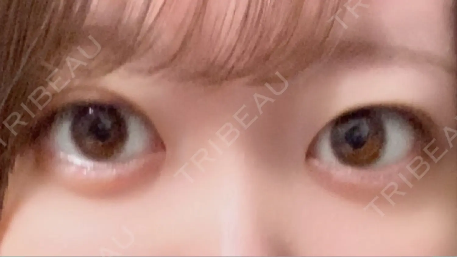 施術前の写真