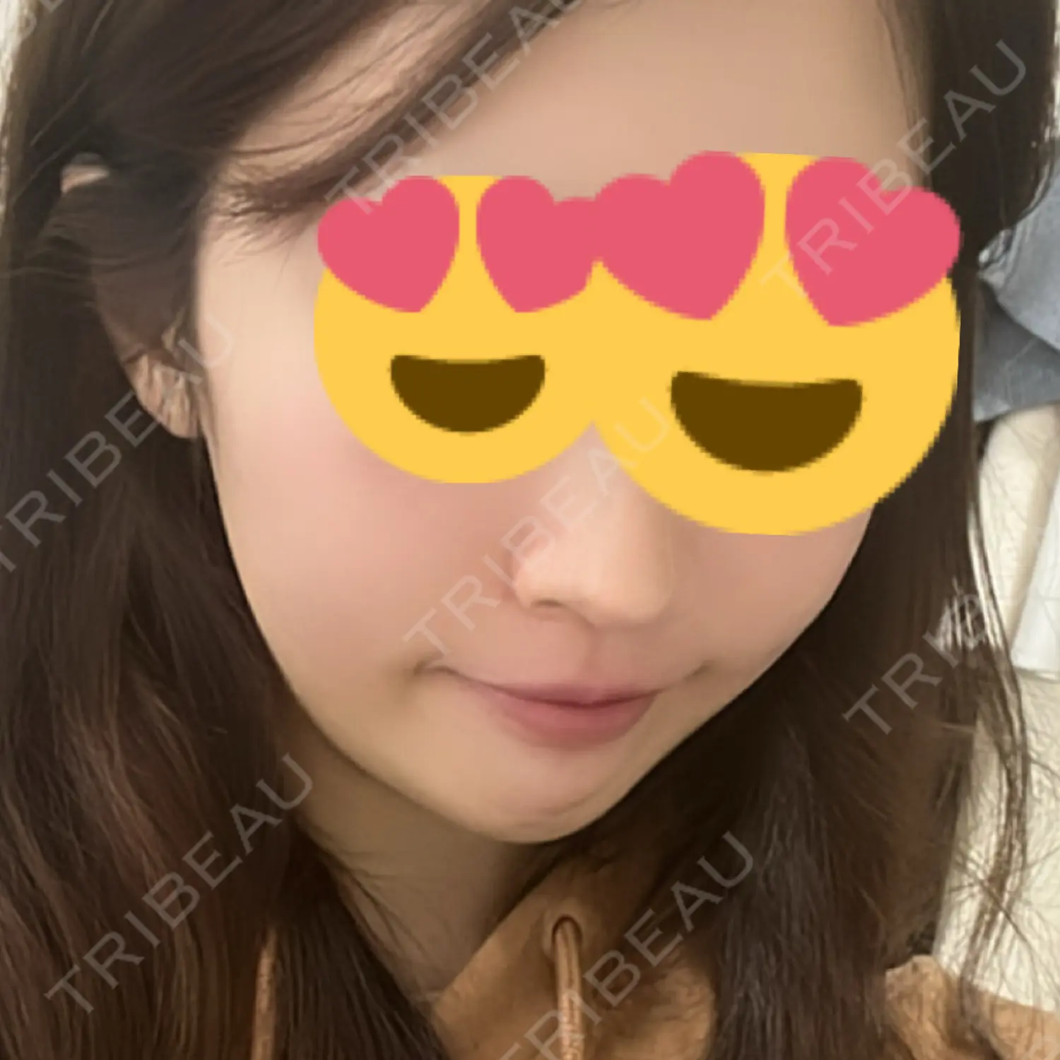 施術前の写真