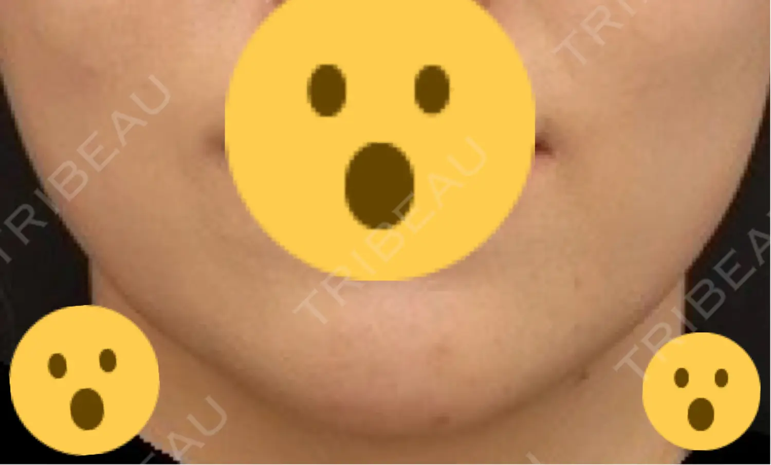 施術前の写真