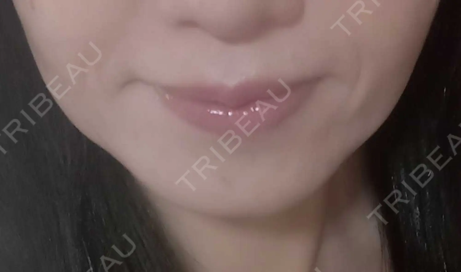 施術前の写真