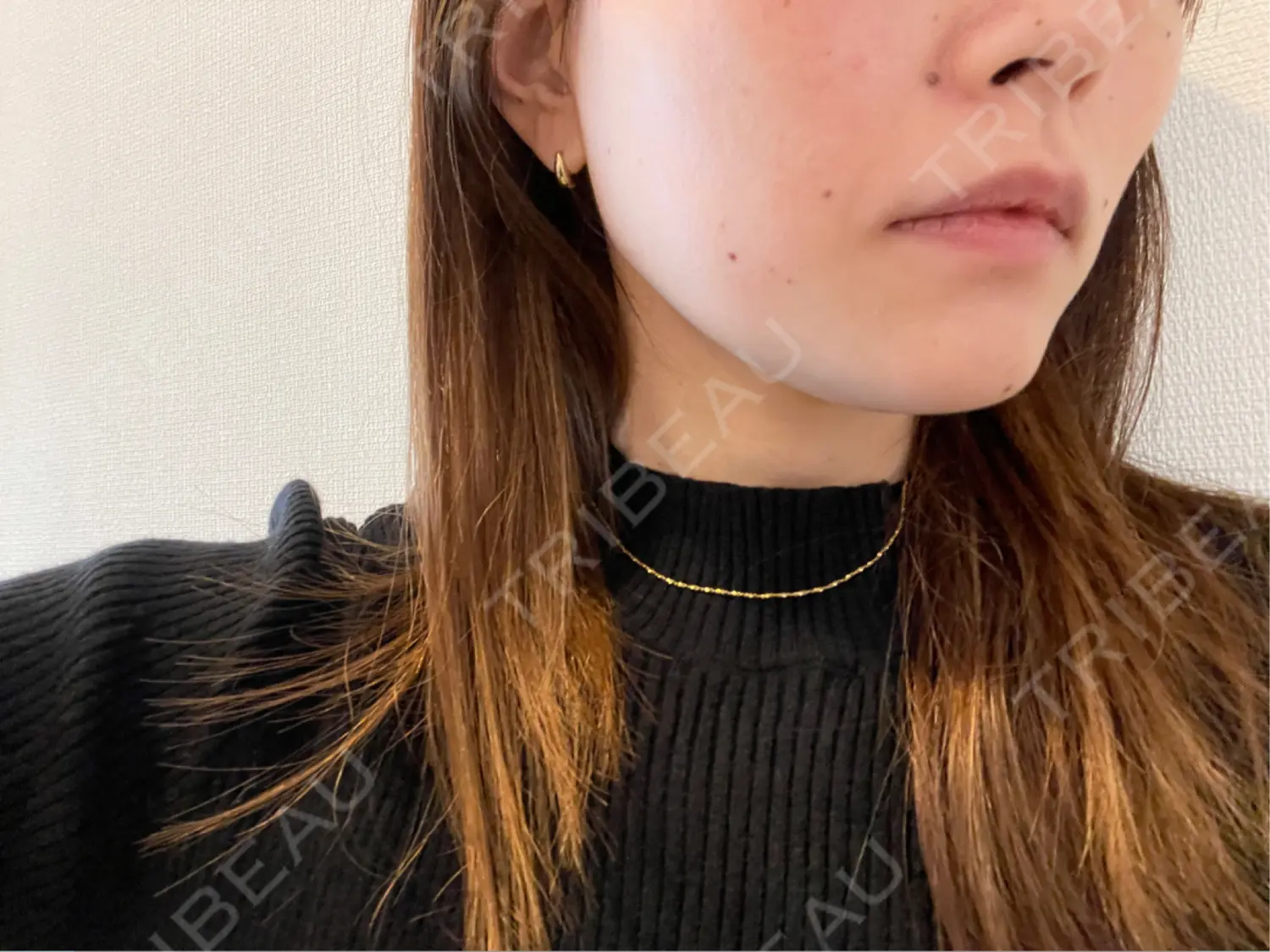 施術前の写真