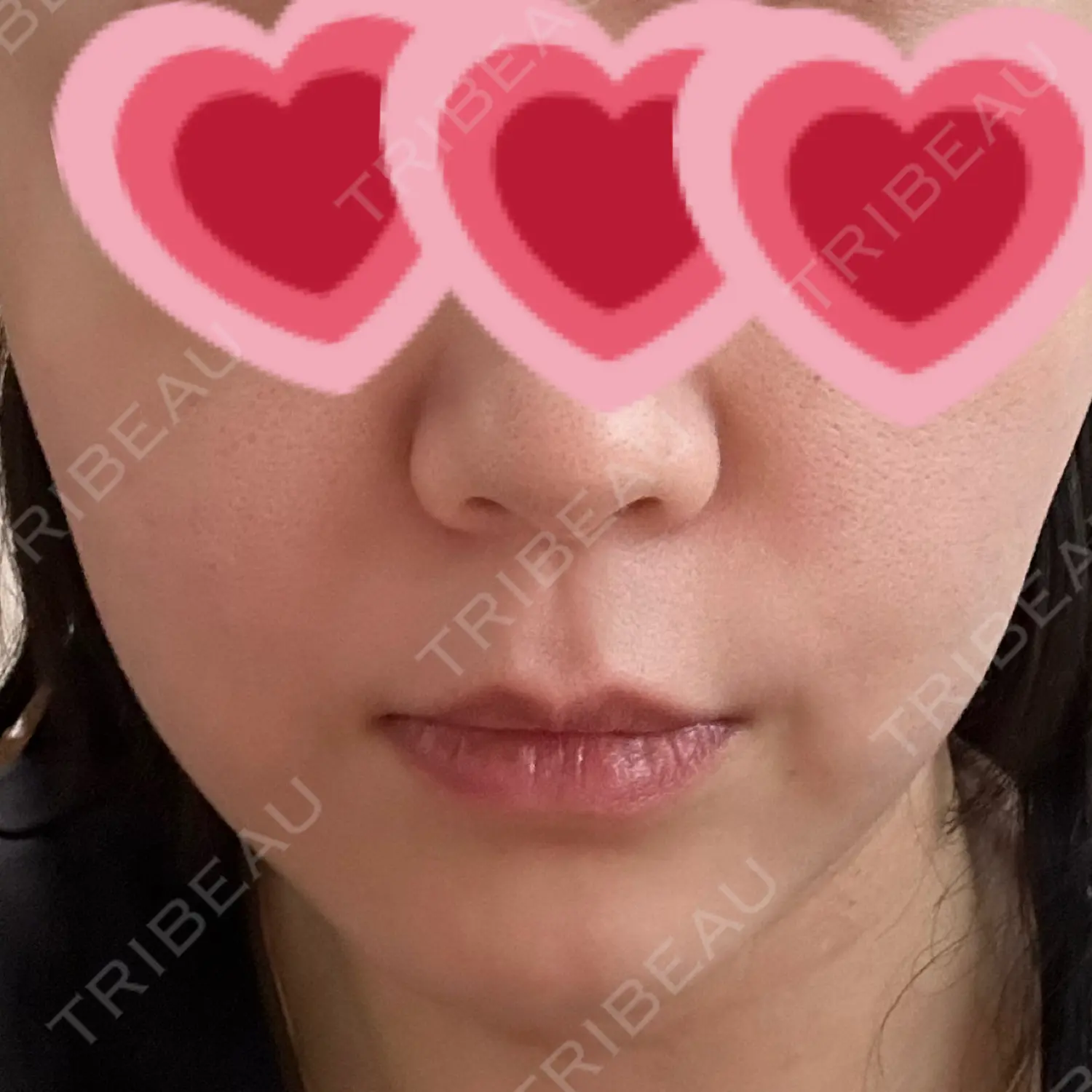 施術前の写真