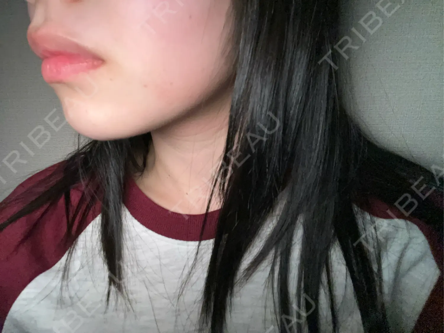 施術前の写真