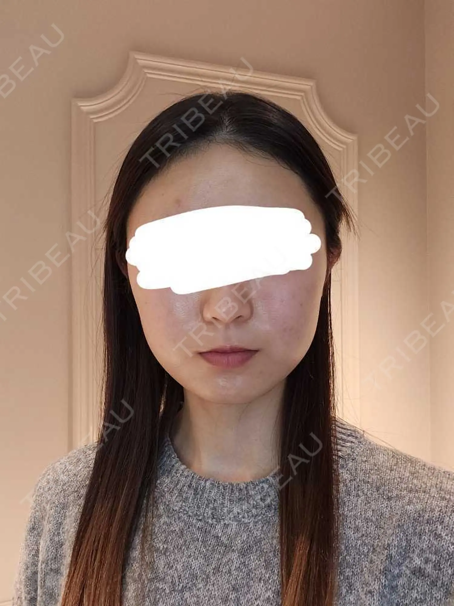 施術前の写真
