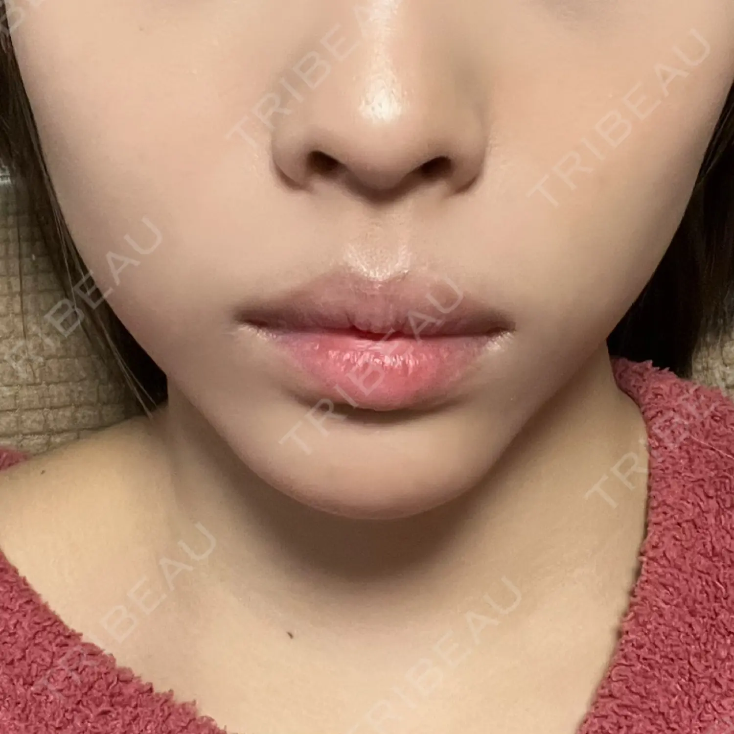 施術前の写真
