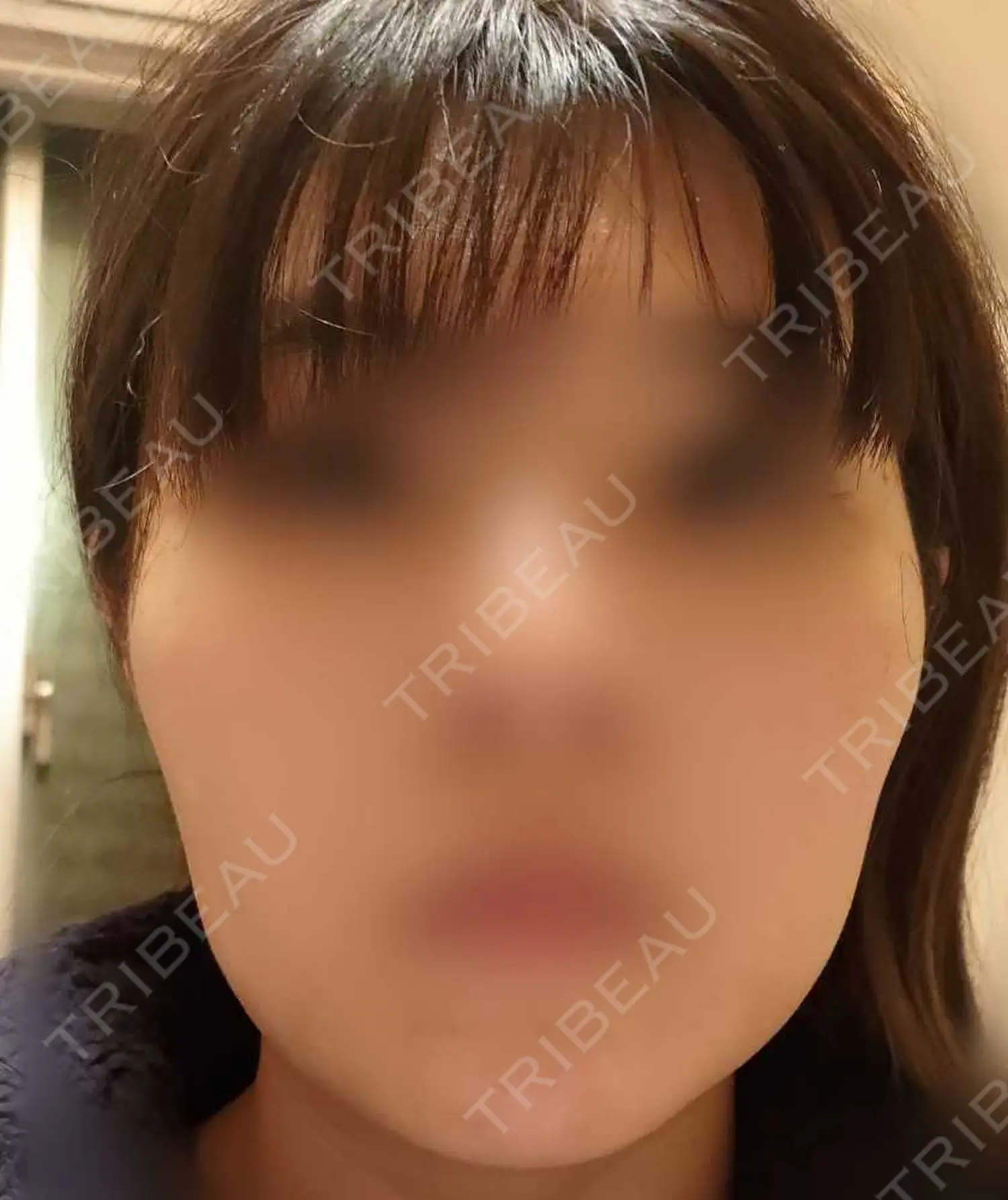 施術前の写真