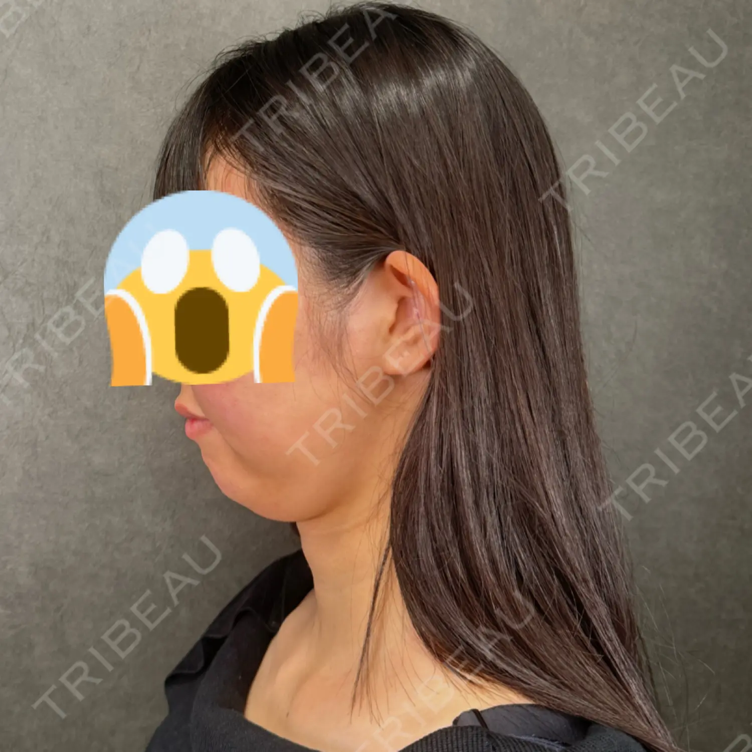 施術前の写真