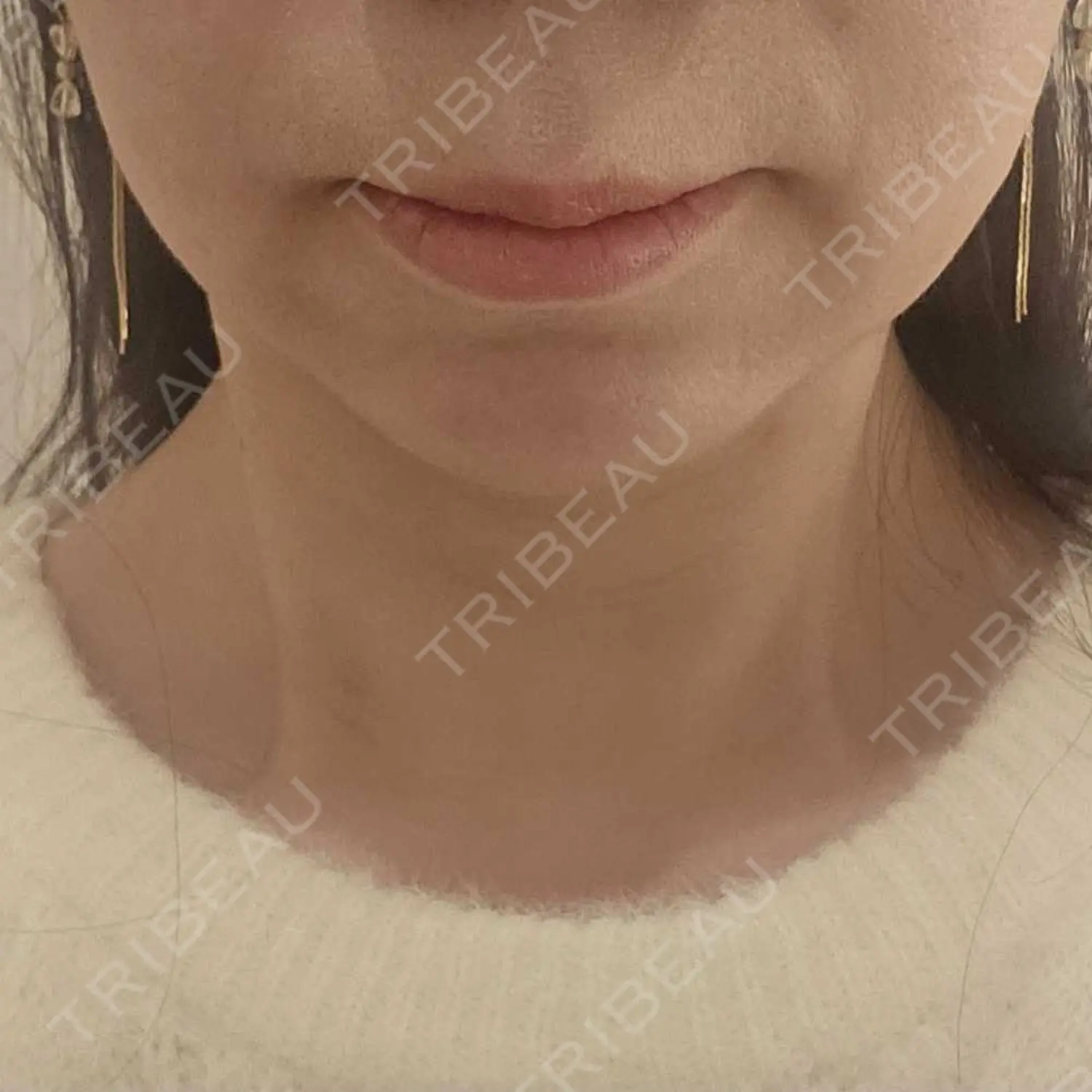 施術前の写真