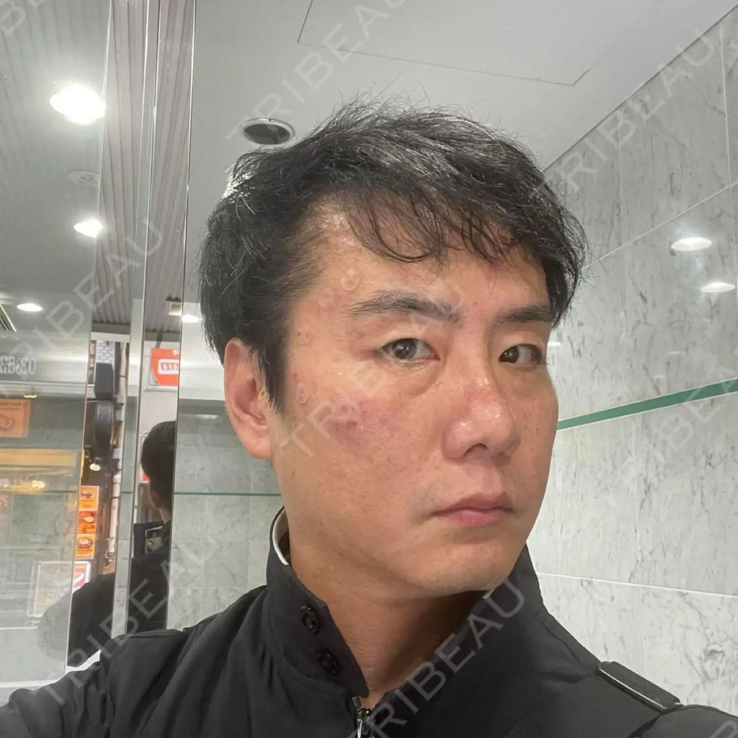 施術前の写真