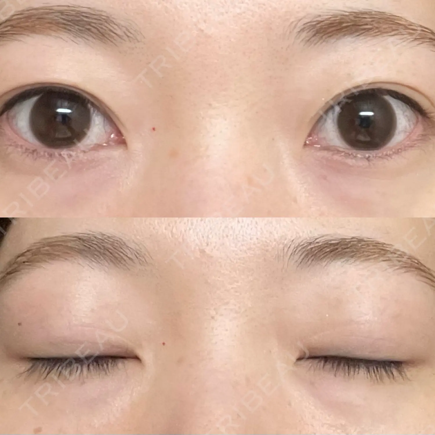 施術前の写真