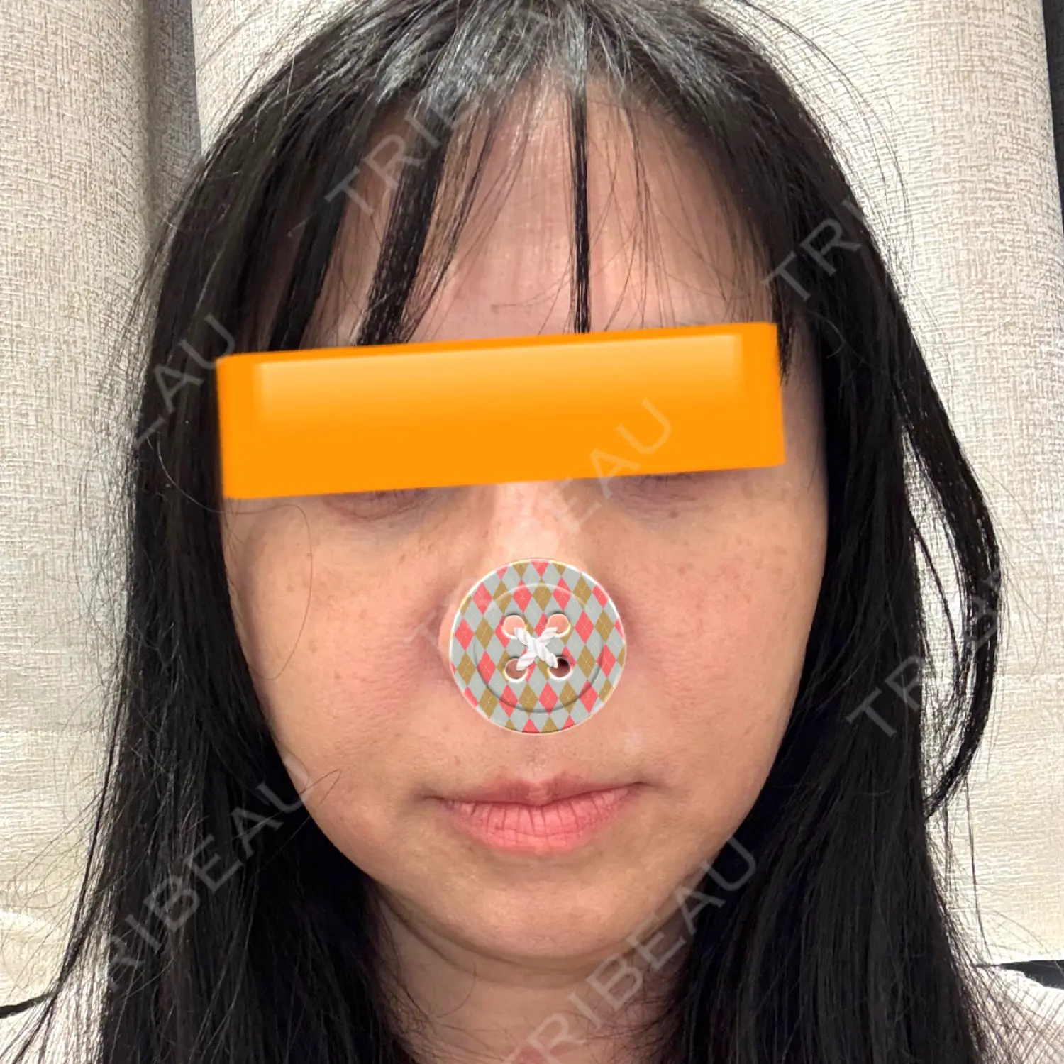 施術前の写真
