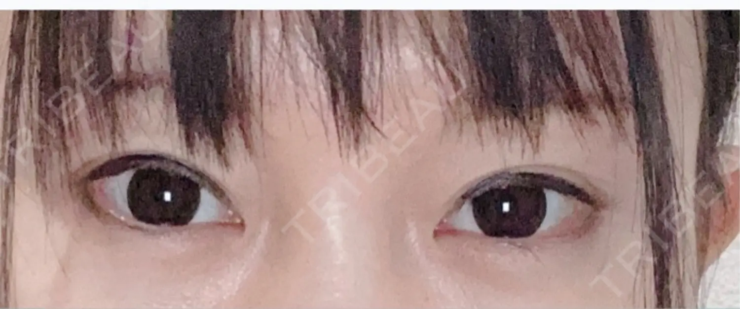 施術前の写真