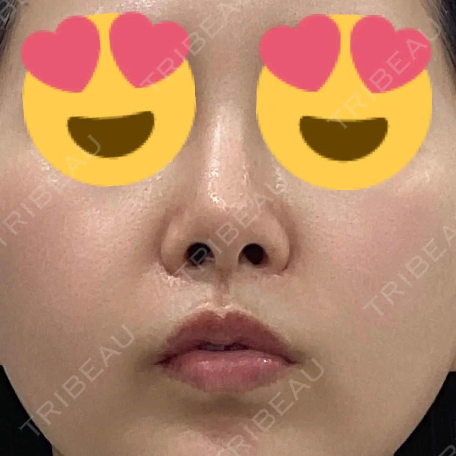 施術前の写真