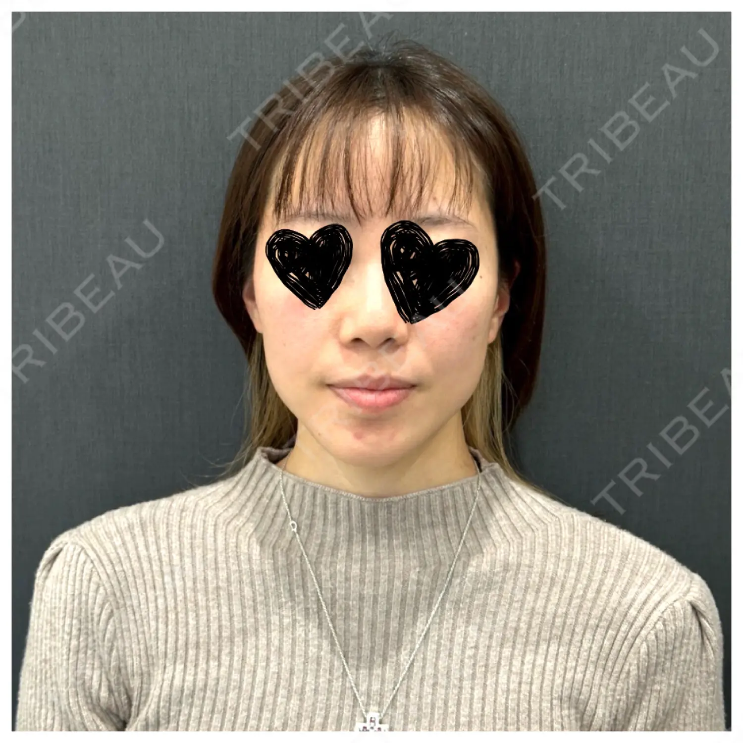 施術前の写真
