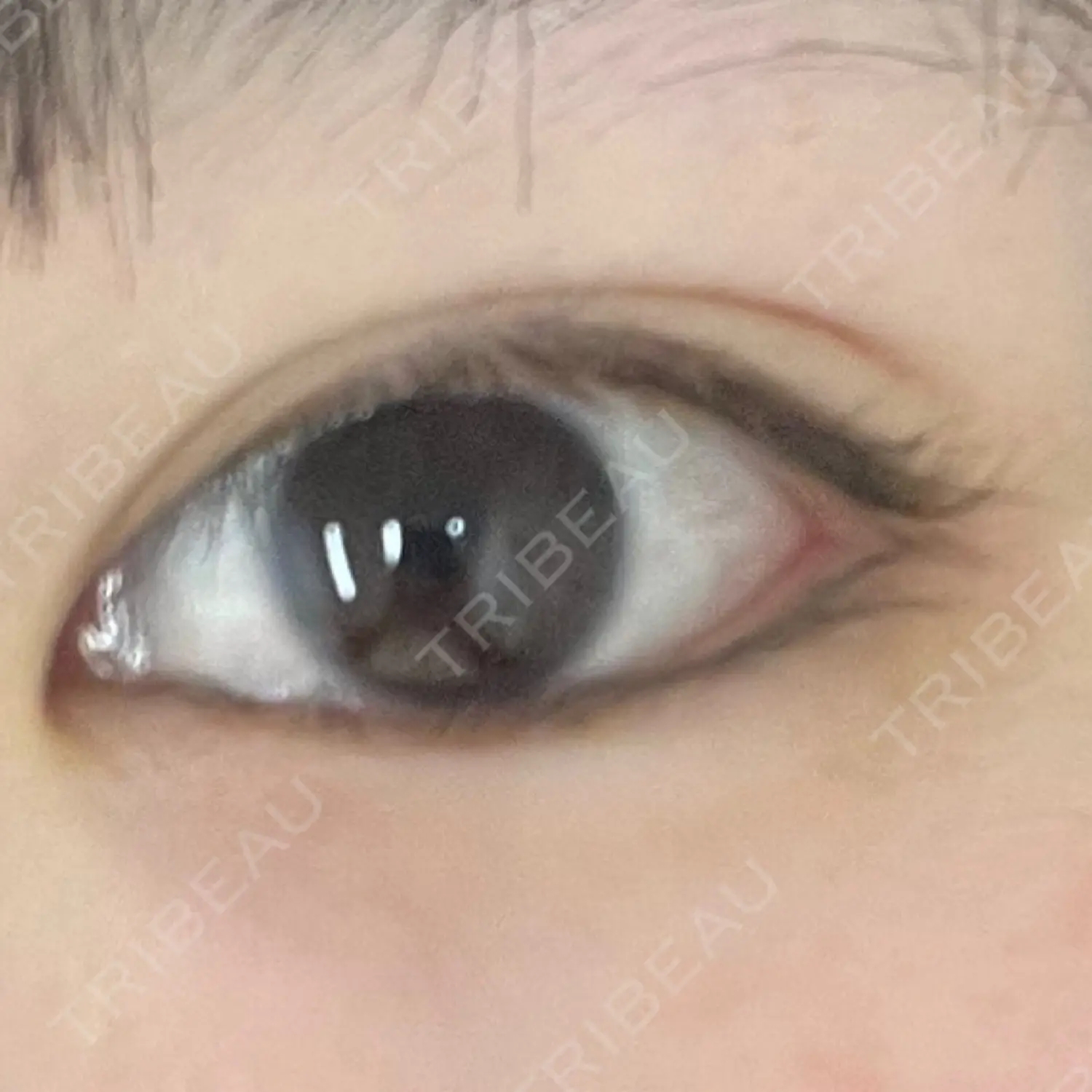 施術前の写真