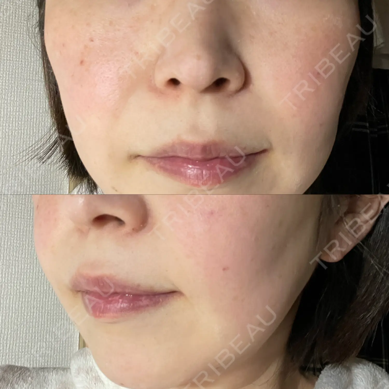 施術前の写真