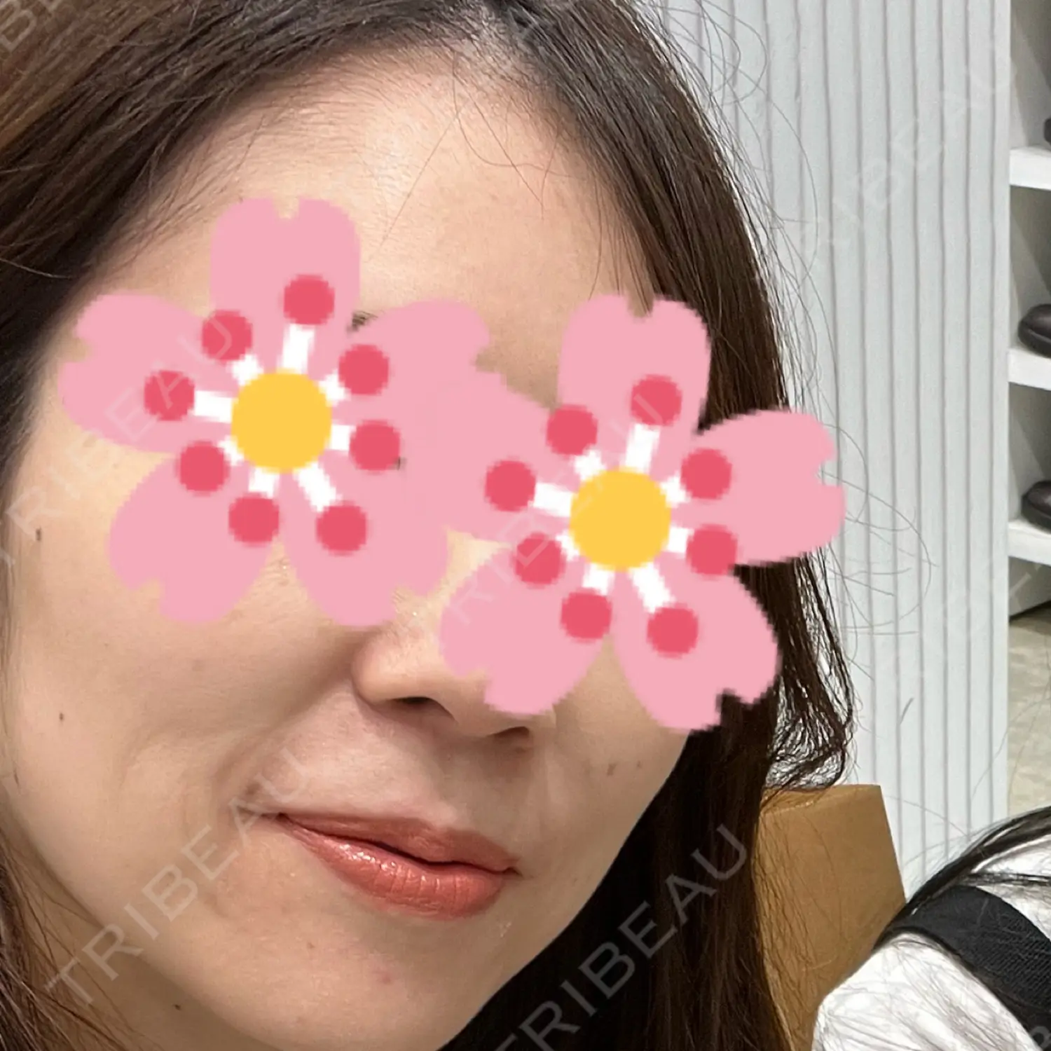 施術前の写真