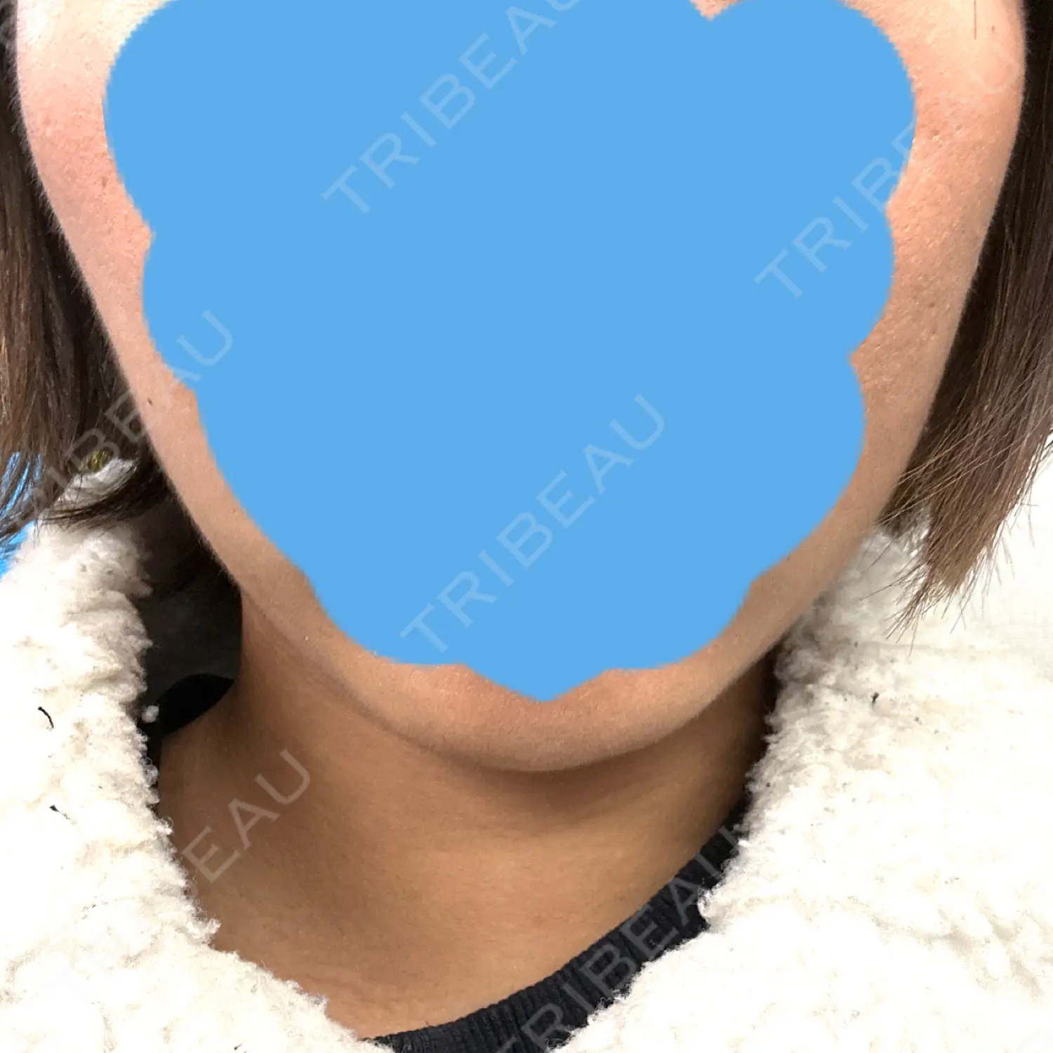 施術前の写真