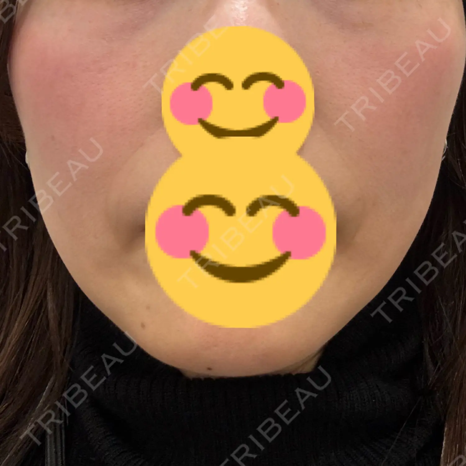 施術前の写真