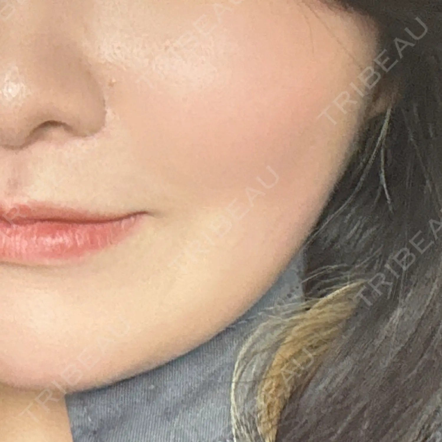 施術前の写真