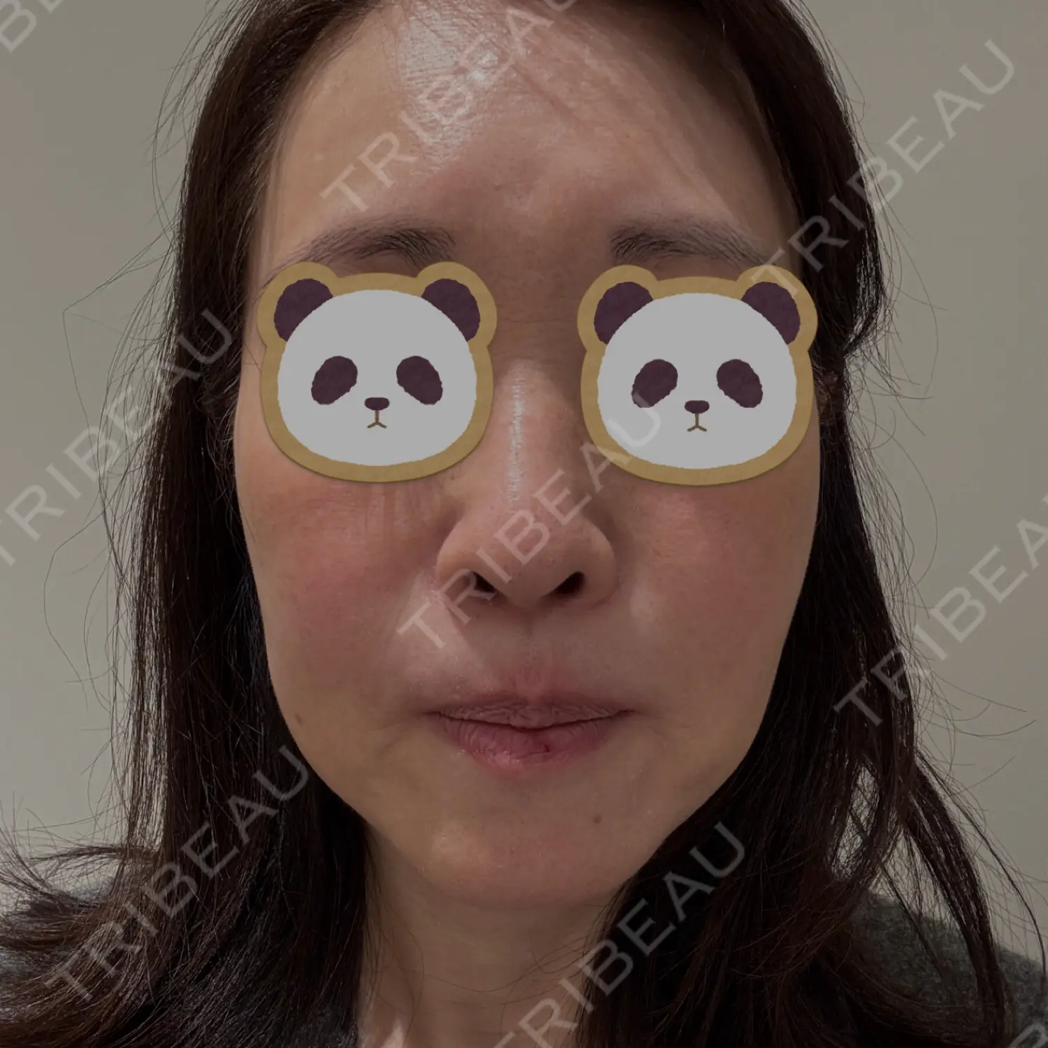 施術前の写真