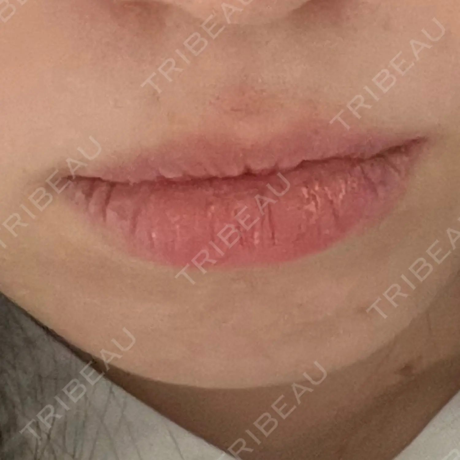 施術前の写真
