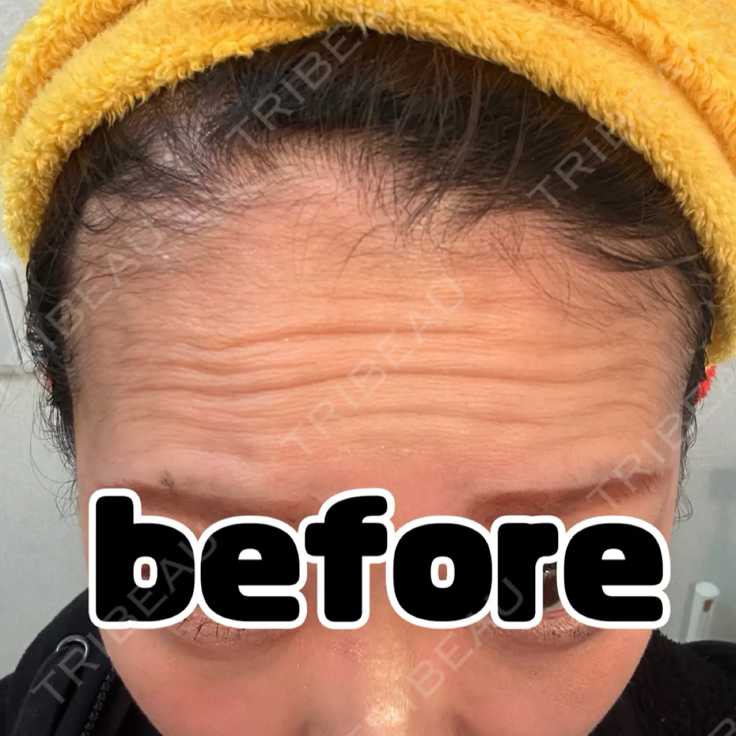 施術前の写真