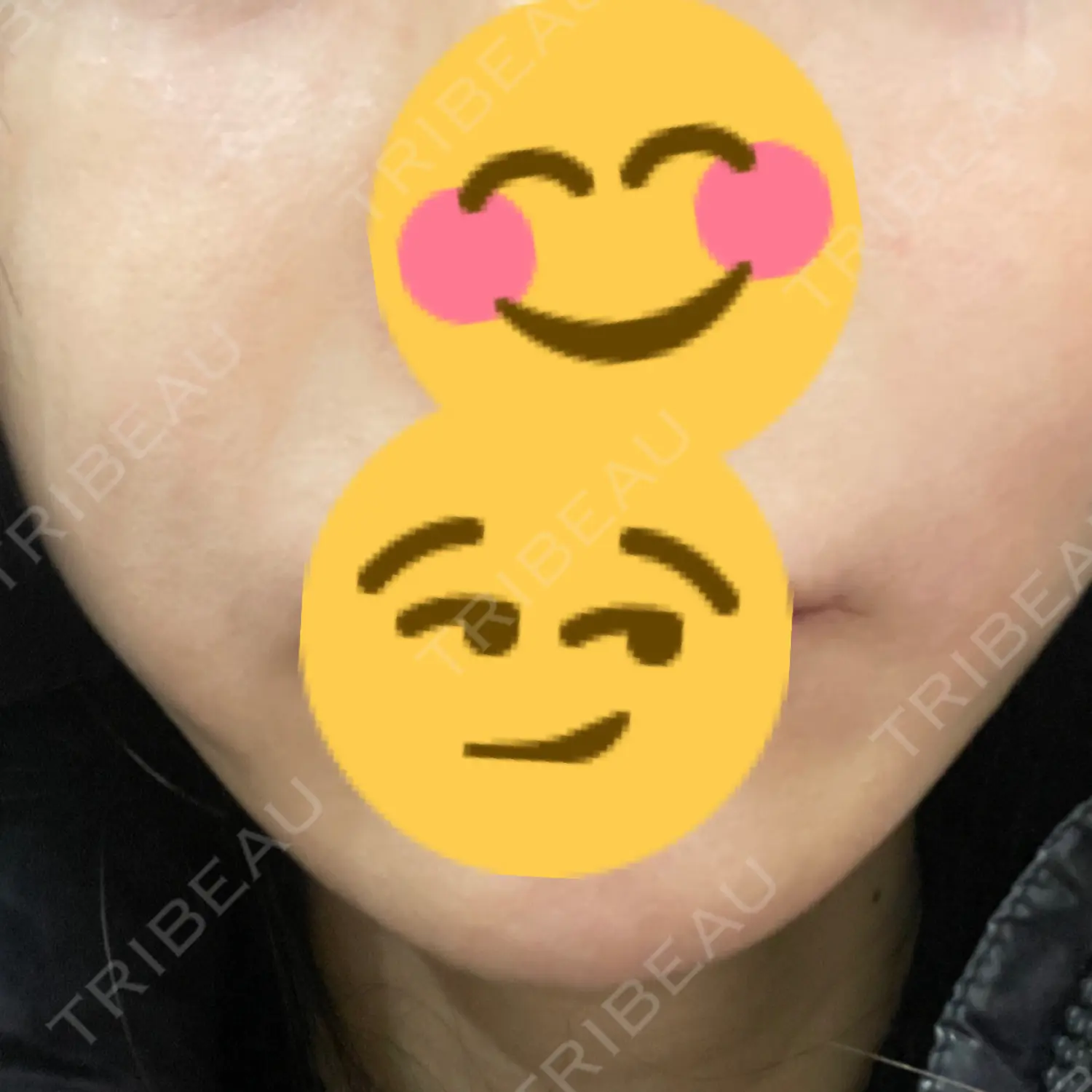 施術前の写真