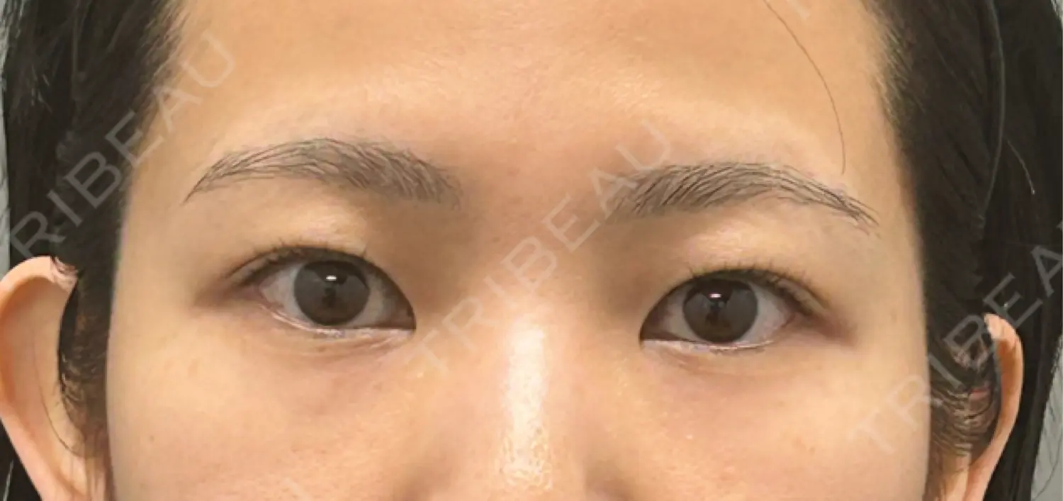 施術前の写真