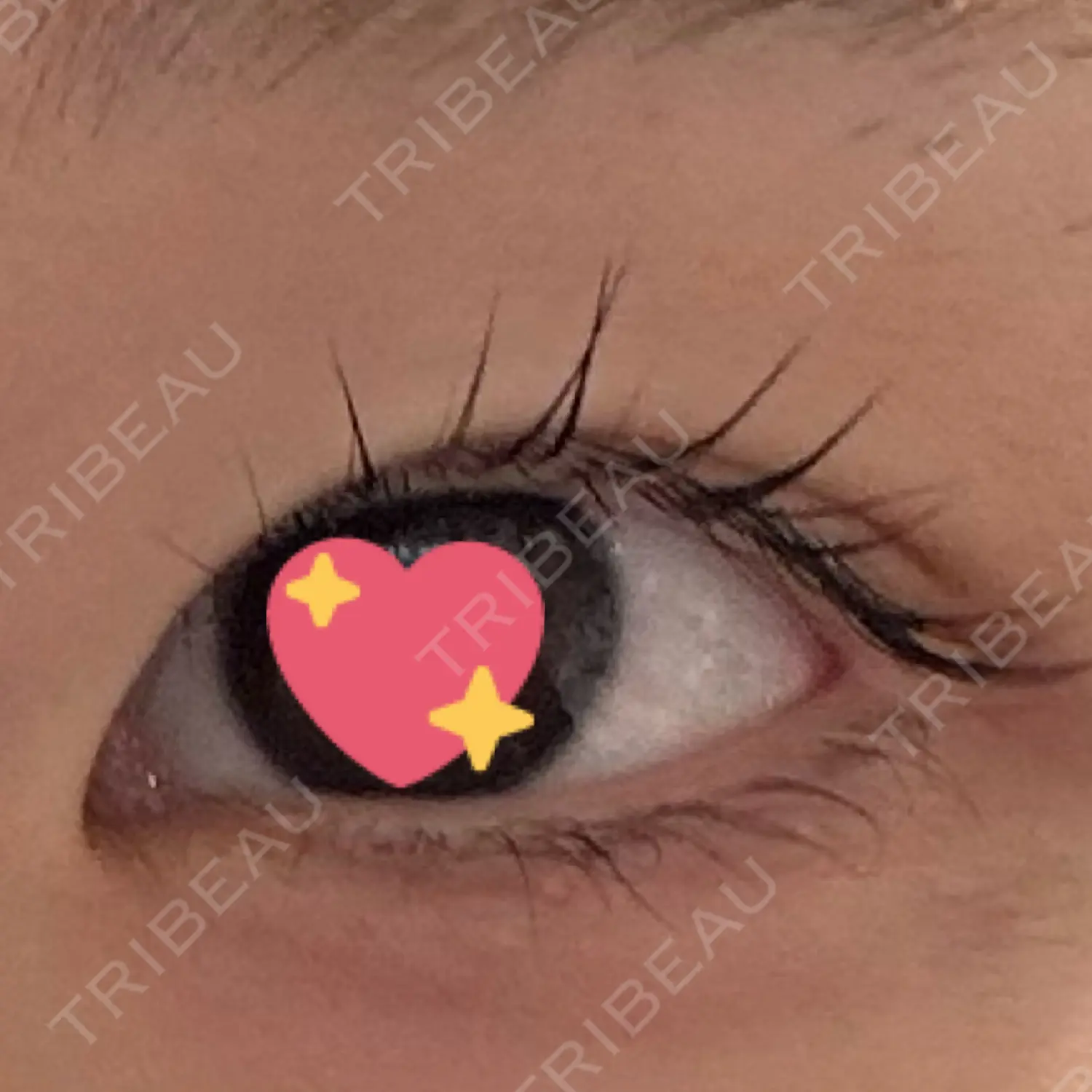 施術前の写真
