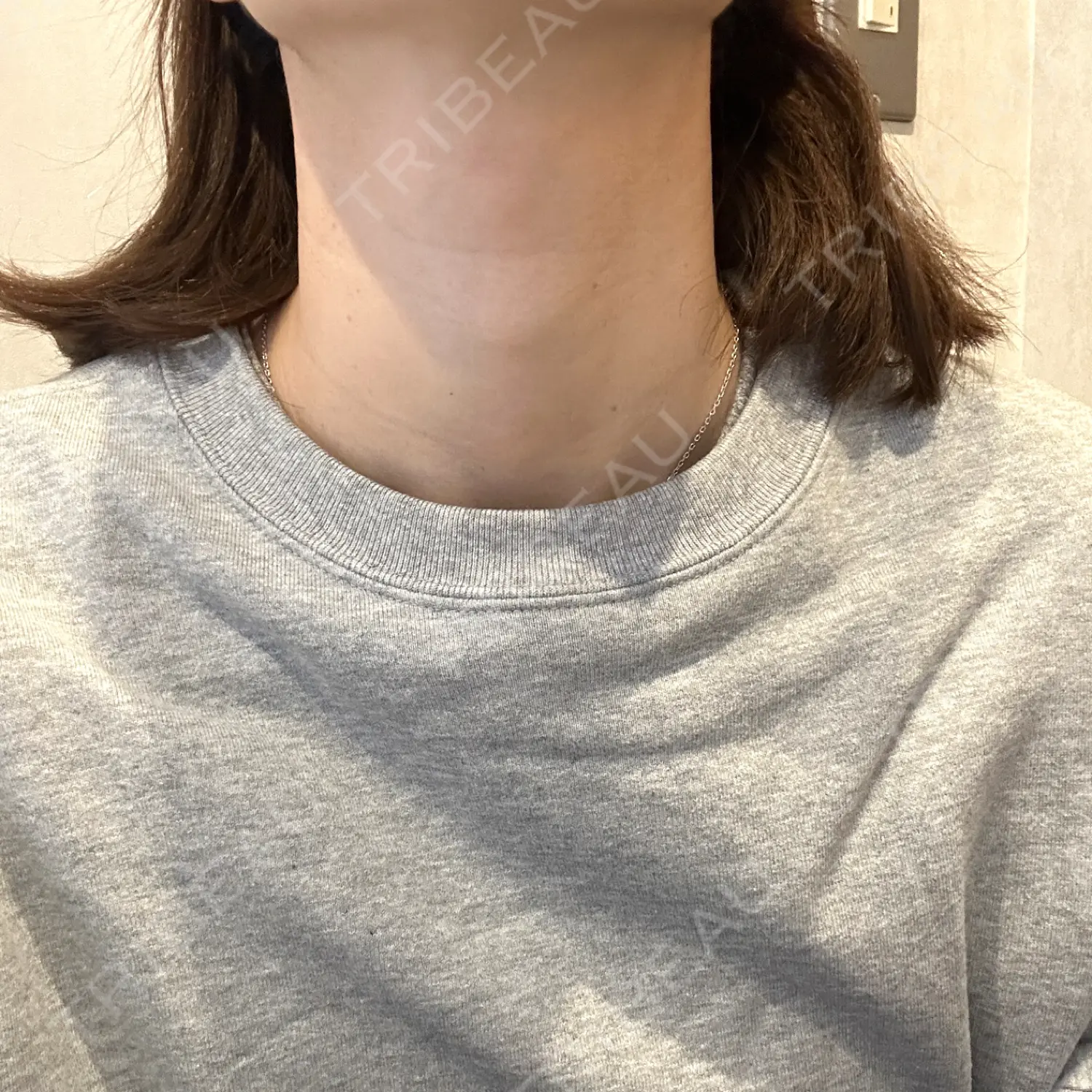 施術前の写真