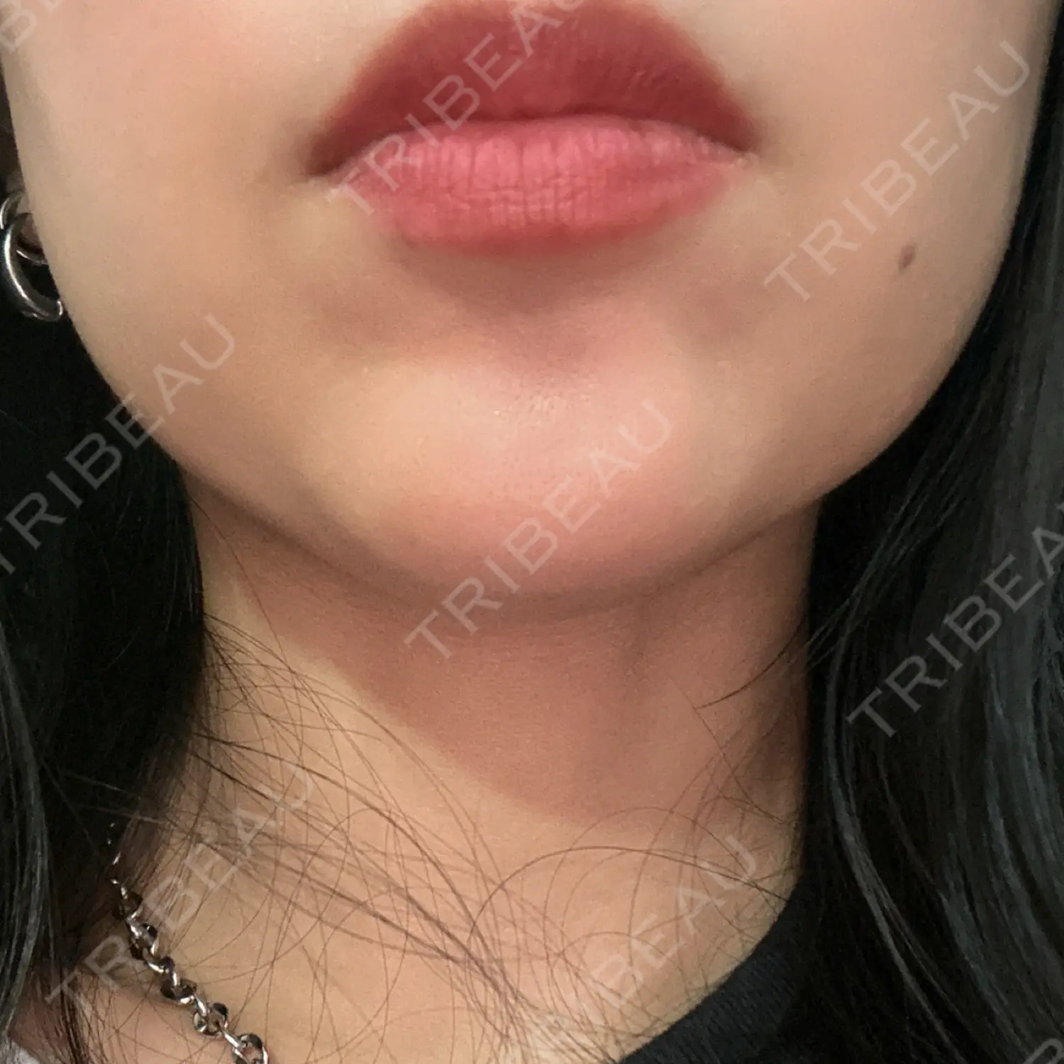 施術前の写真