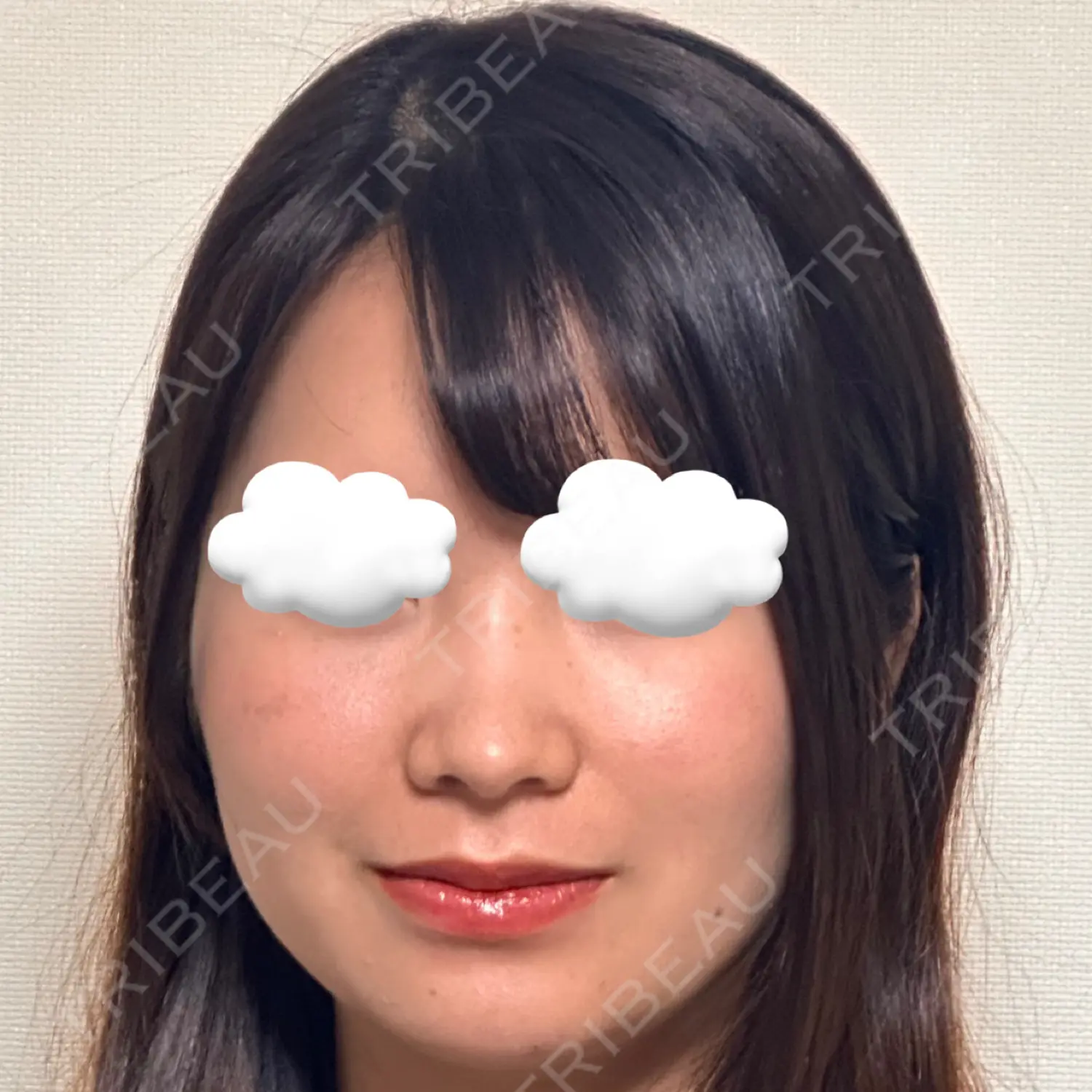 施術前の写真
